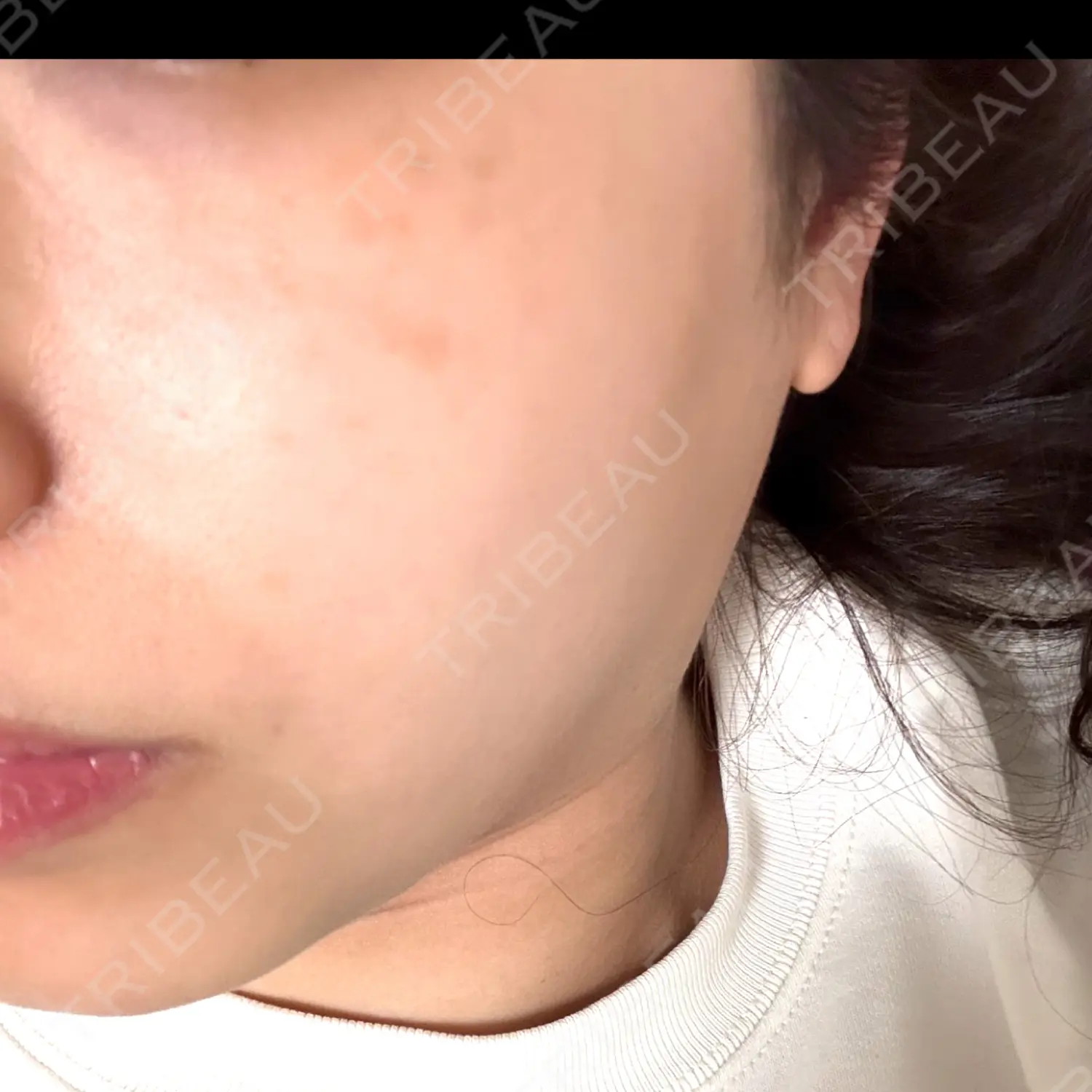 施術前の写真