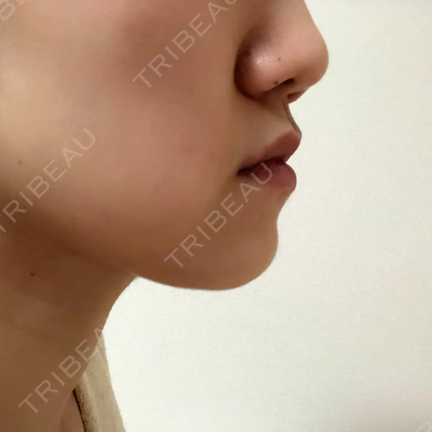 施術前の写真