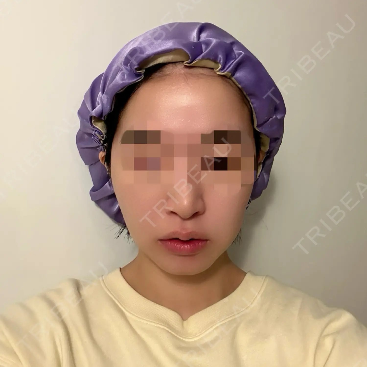 施術前の写真