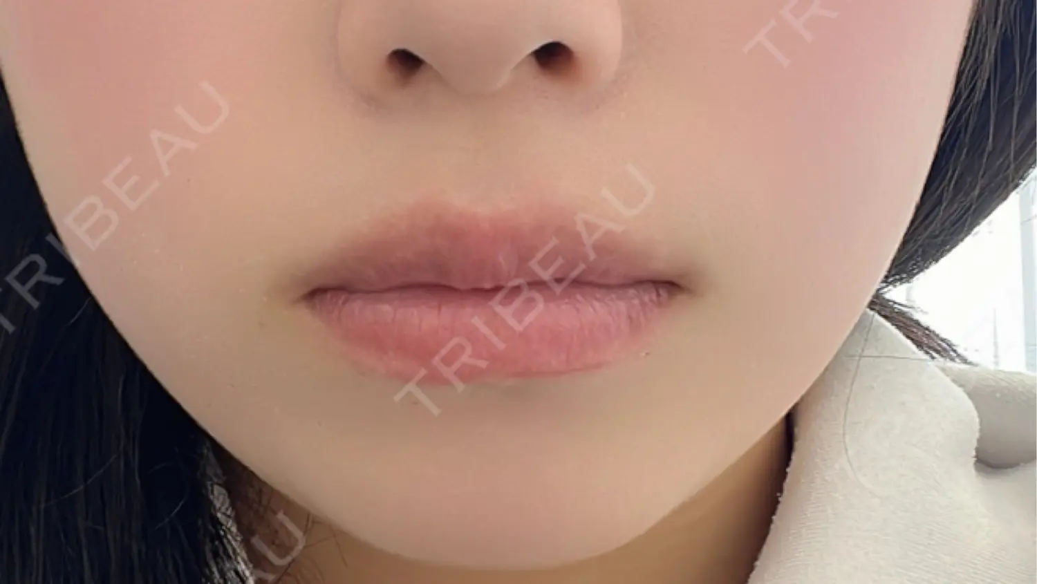 施術前の写真