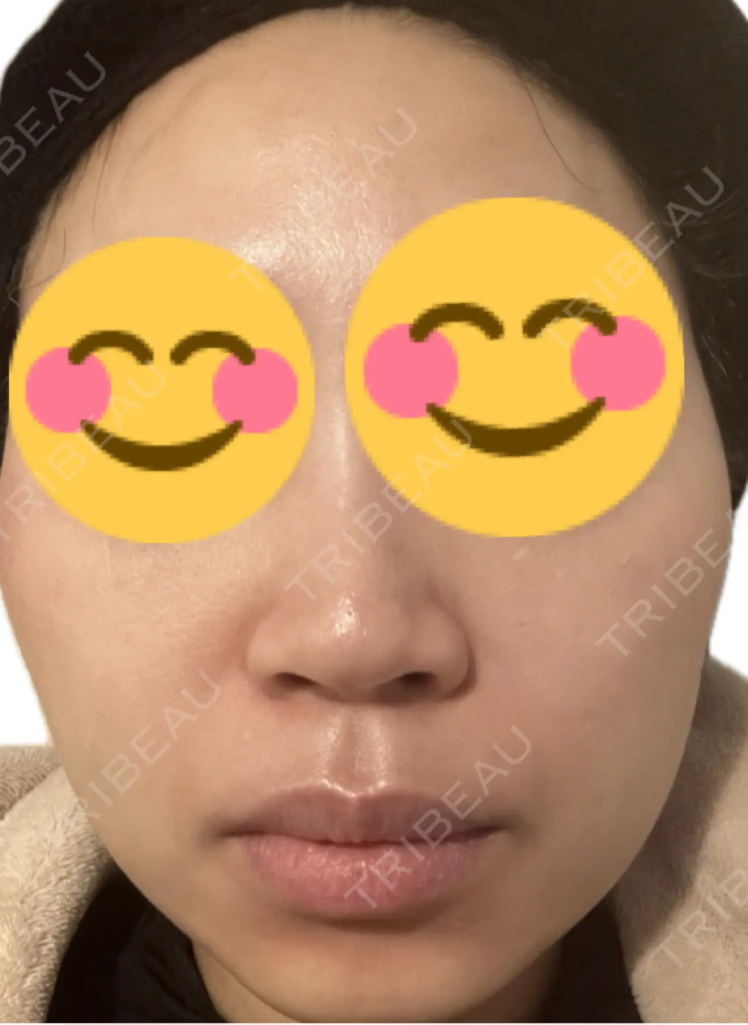施術前の写真
