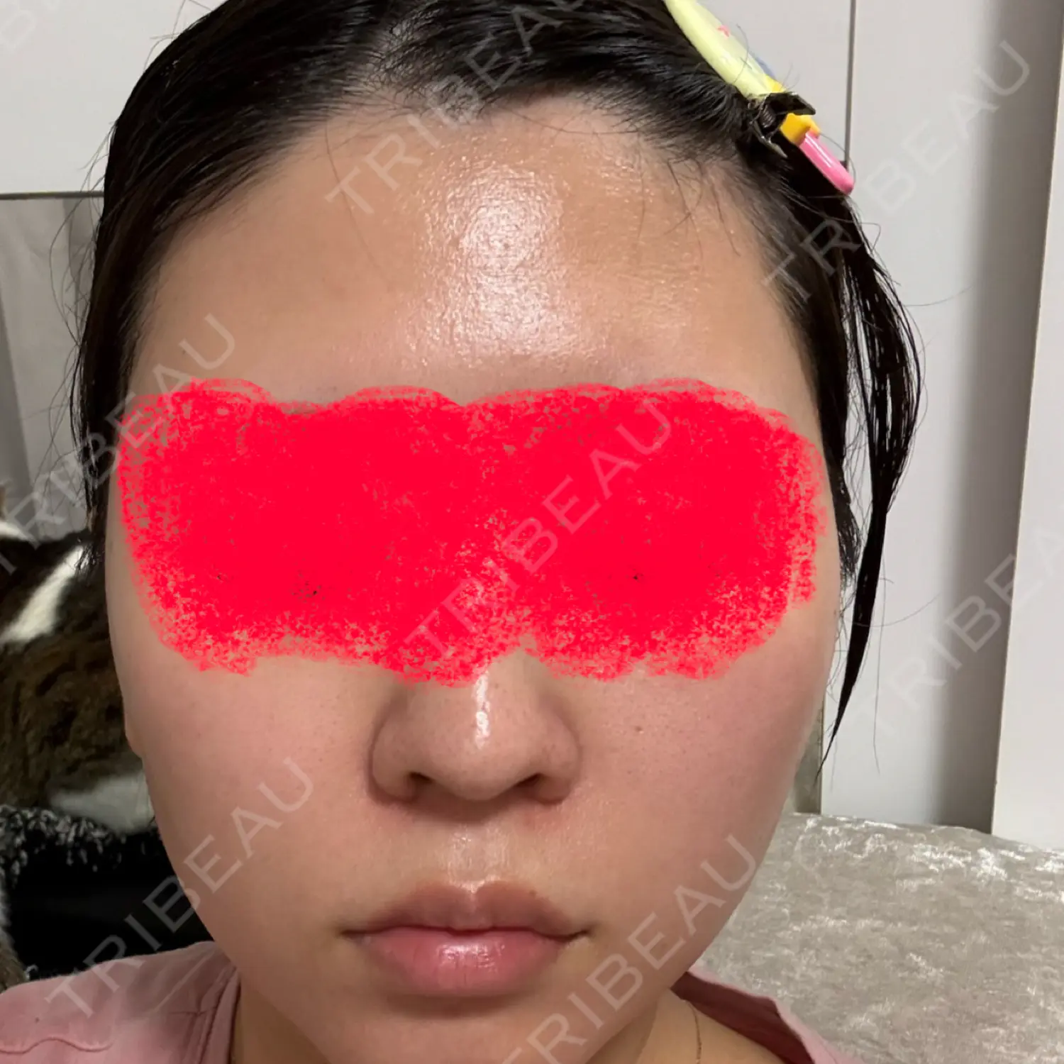 施術前の写真