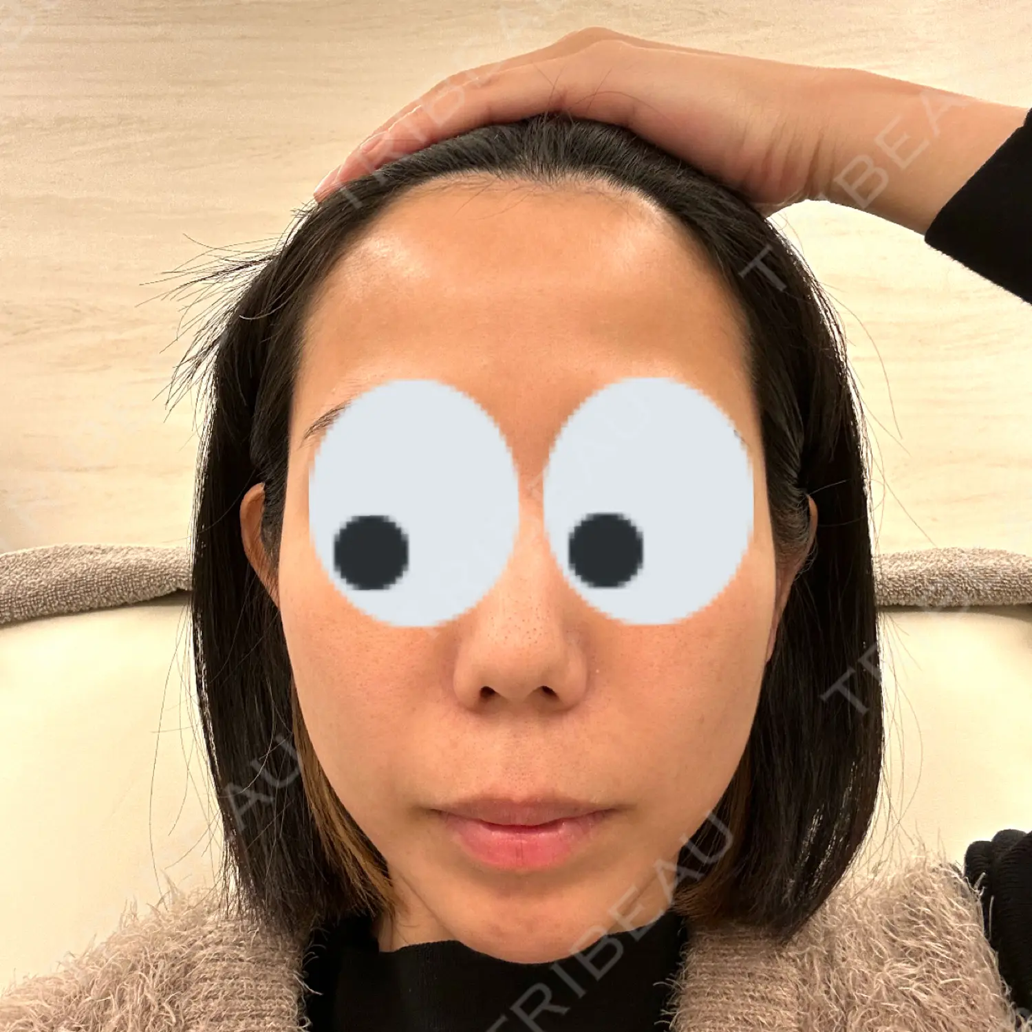 施術前の写真