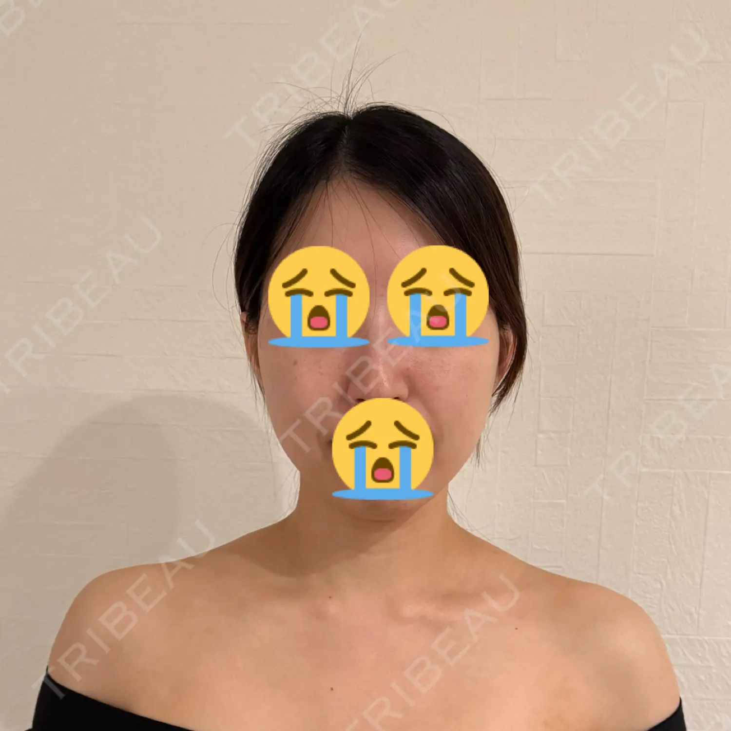 施術前の写真