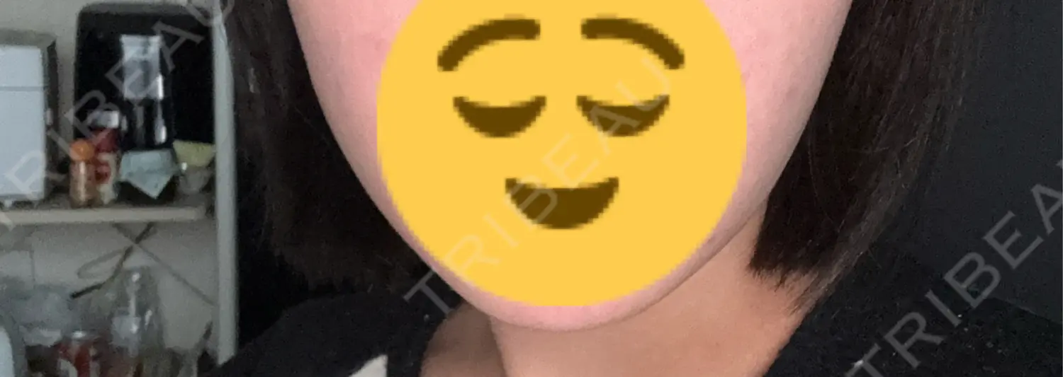 施術前の写真