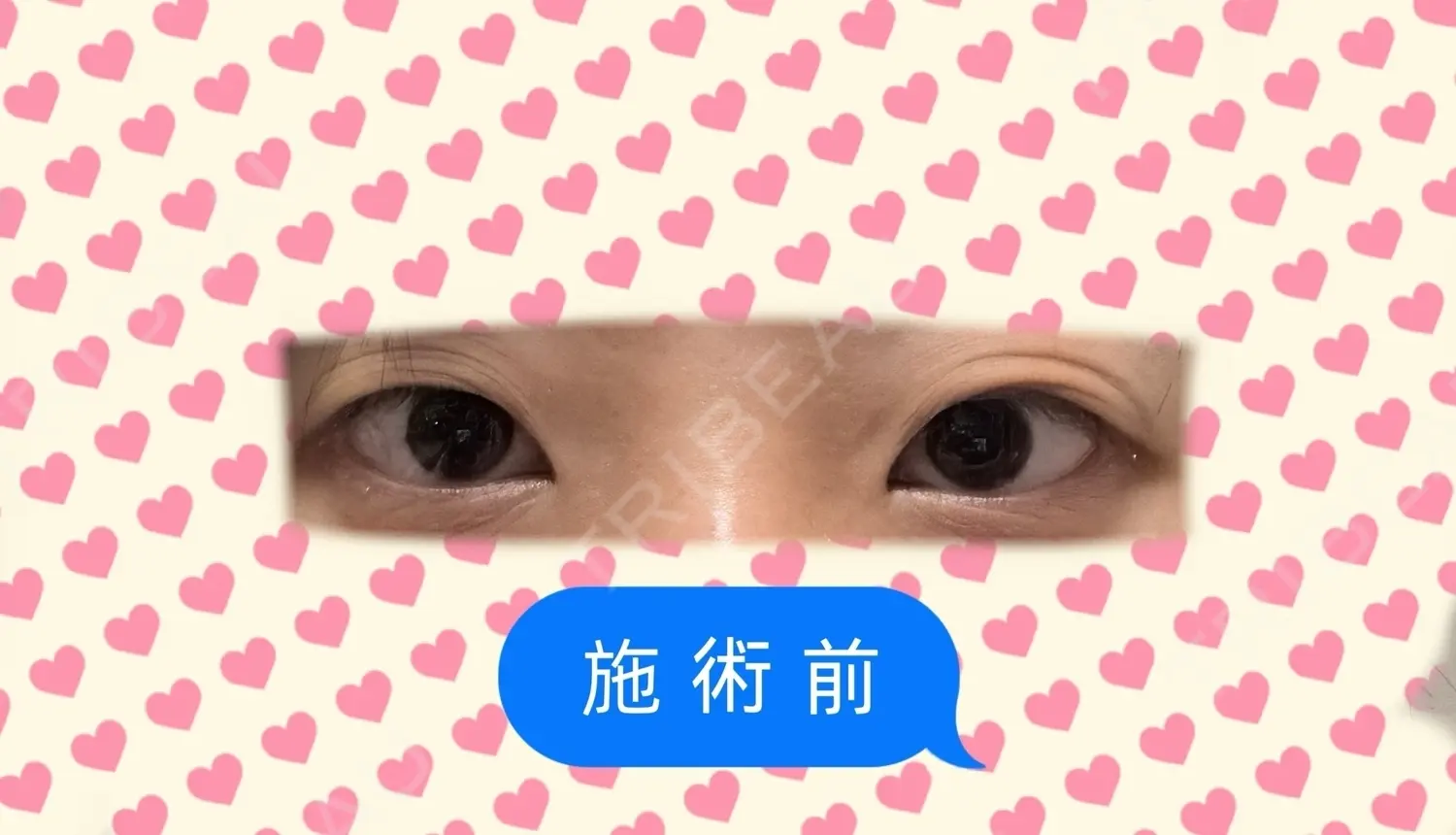 施術前の写真