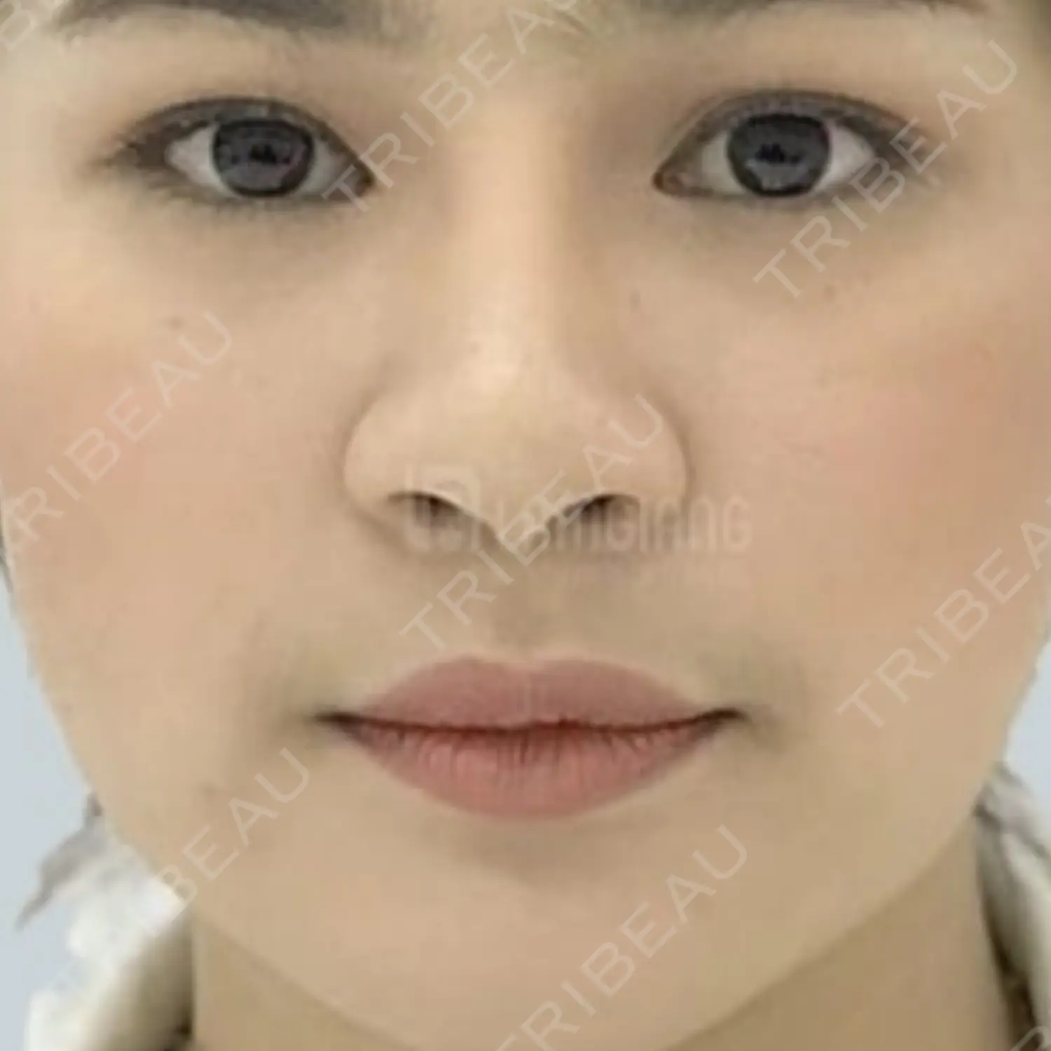 施術前の写真
