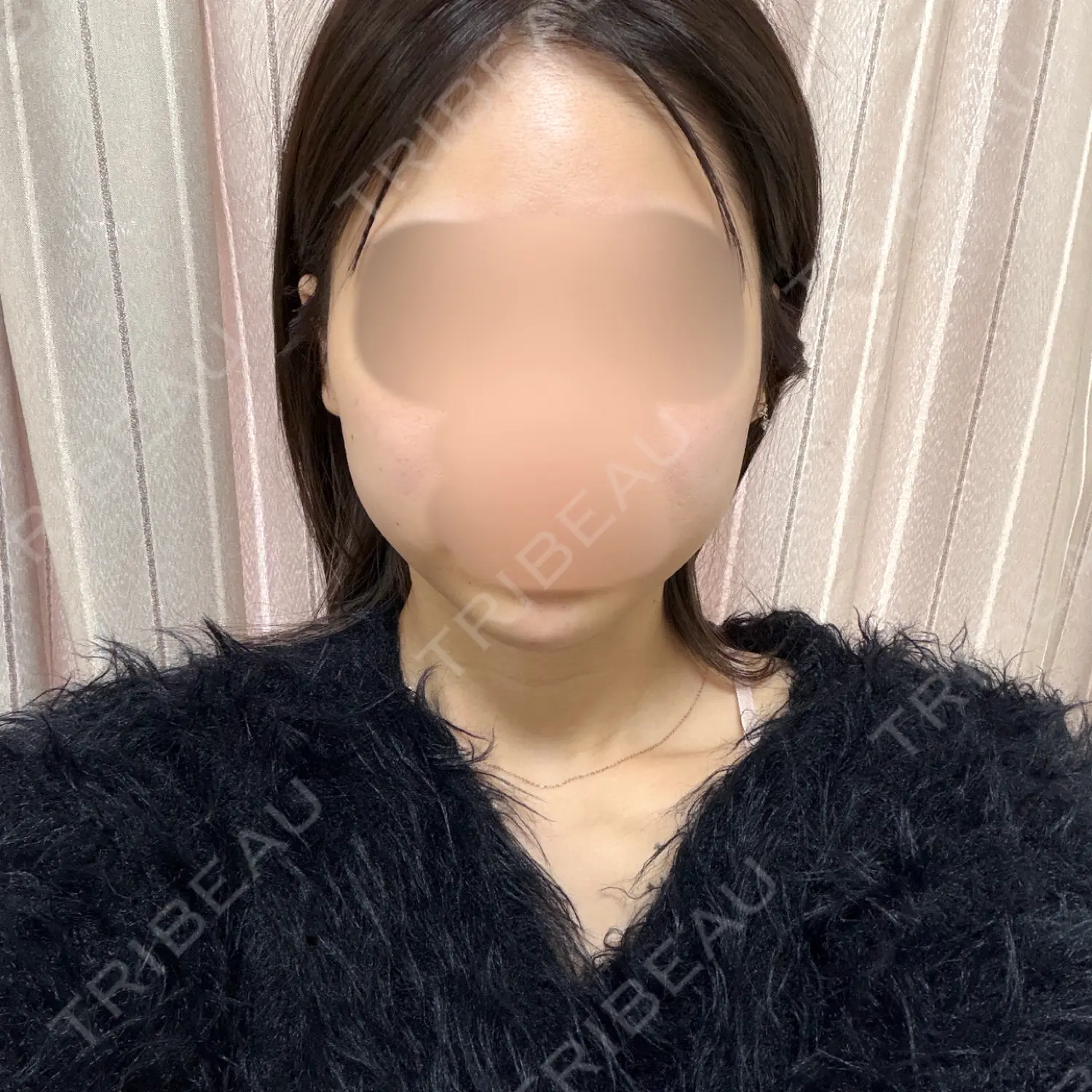 施術前の写真