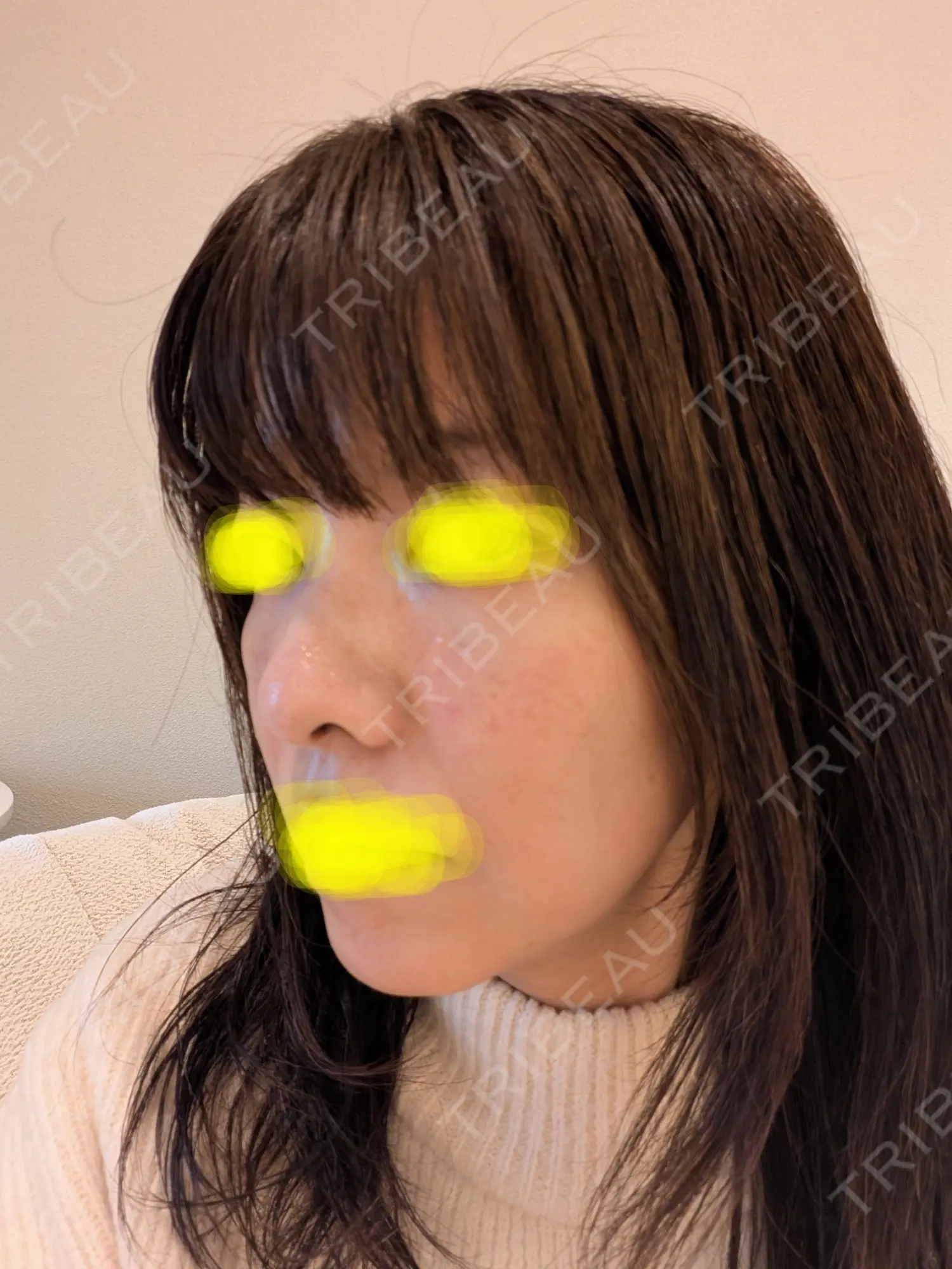 施術前の写真