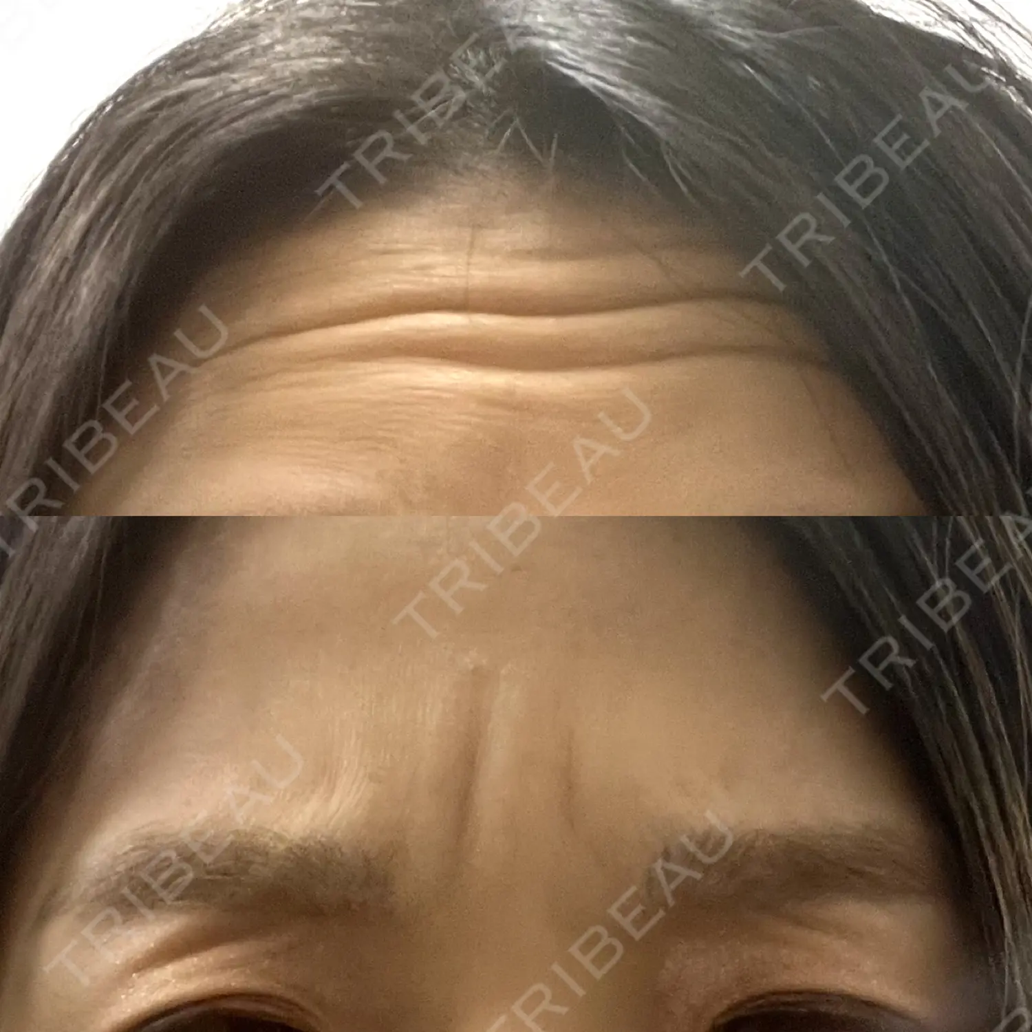 施術前の写真