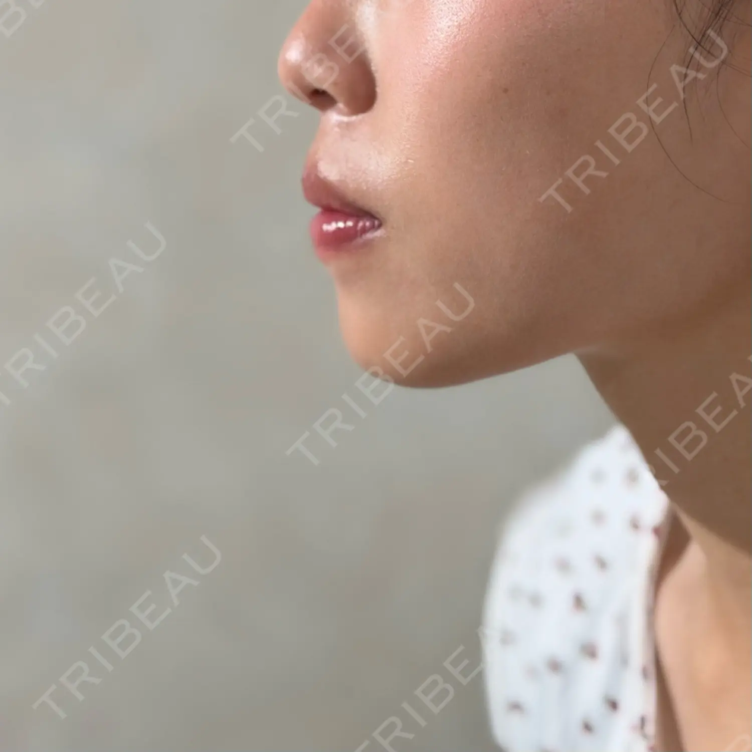 施術前の写真