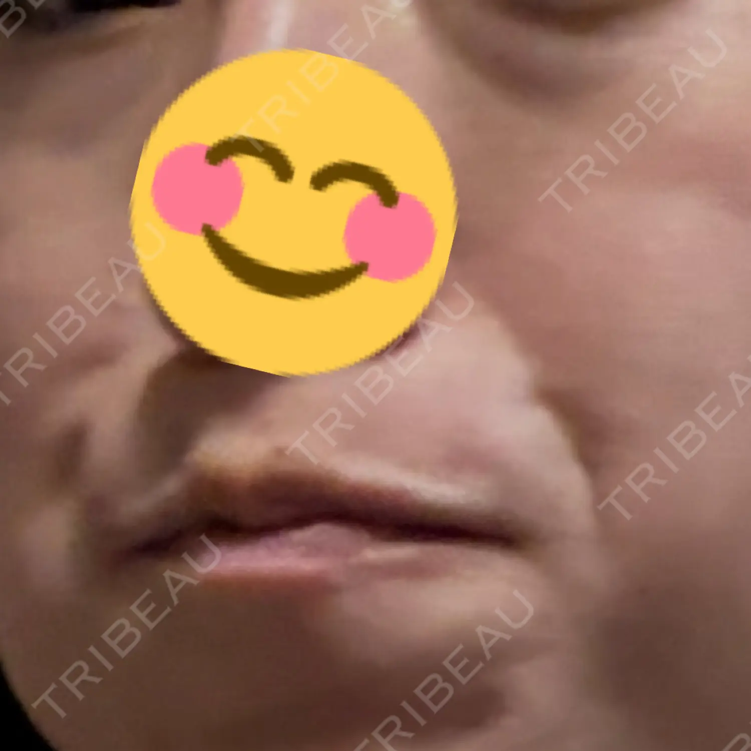 施術前の写真