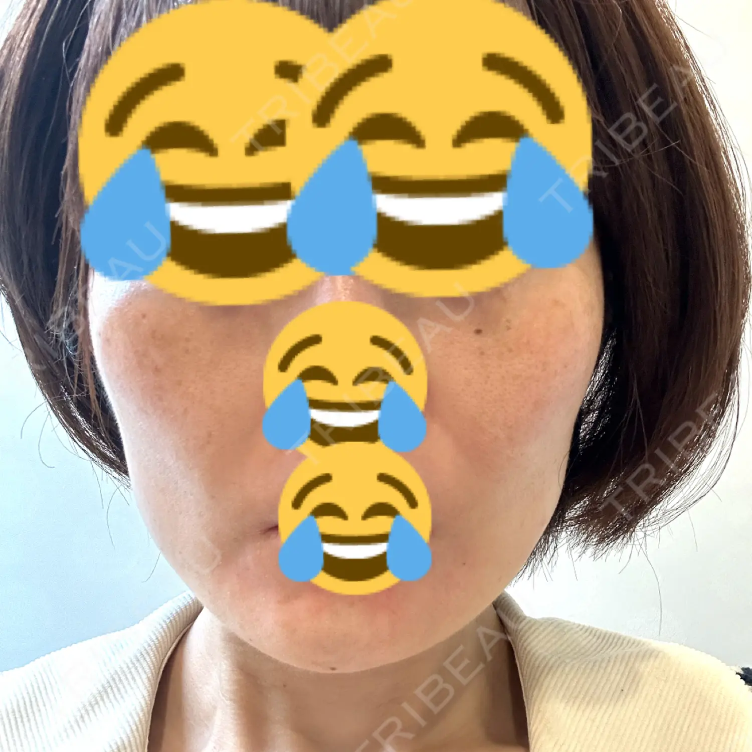 施術前の写真