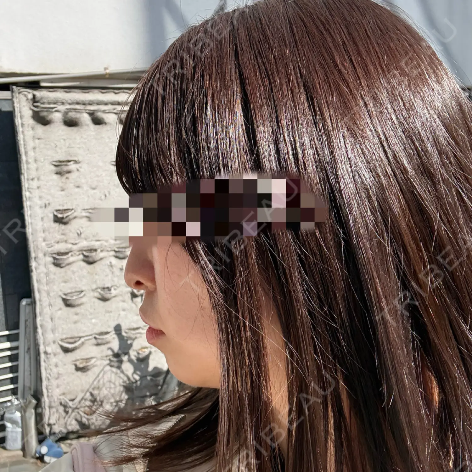 施術前の写真