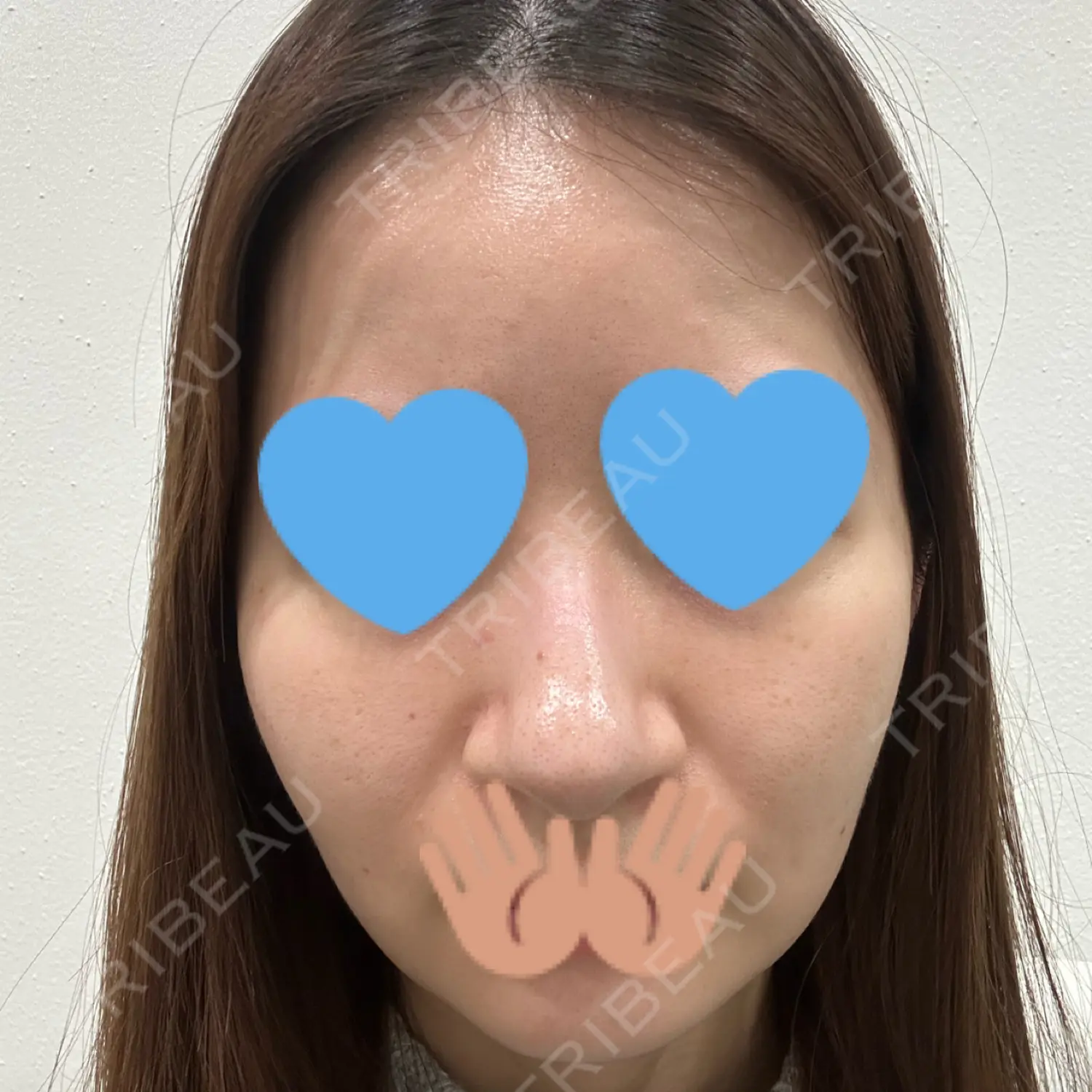 施術前の写真