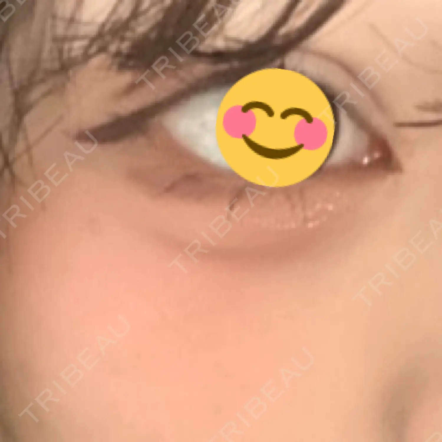 施術前の写真