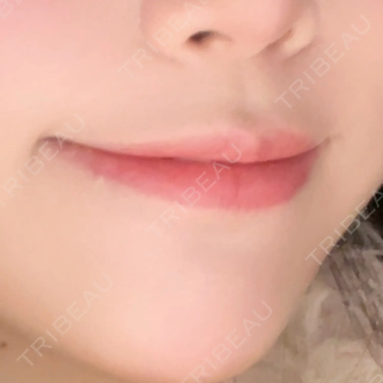 施術前の写真