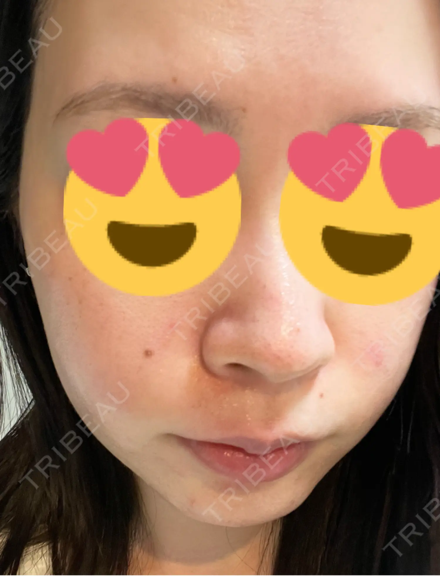 施術前の写真