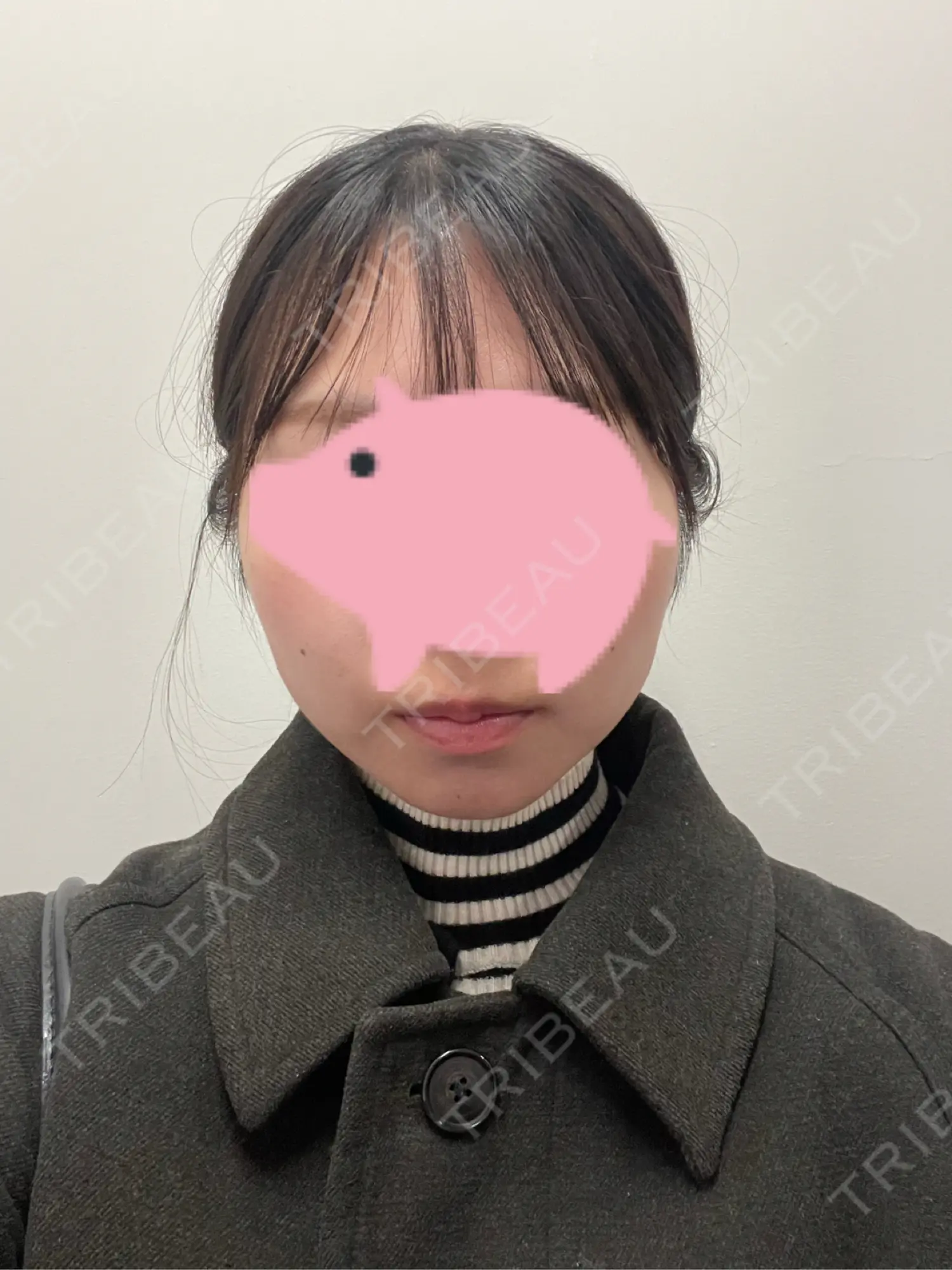 施術前の写真