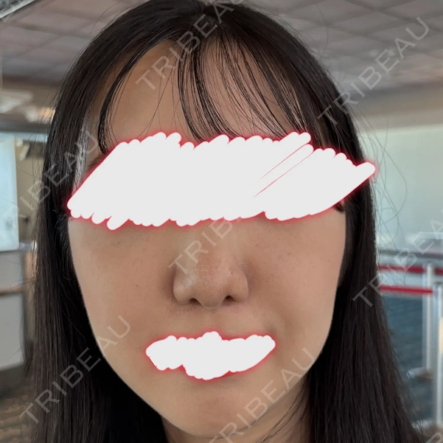 施術前の写真