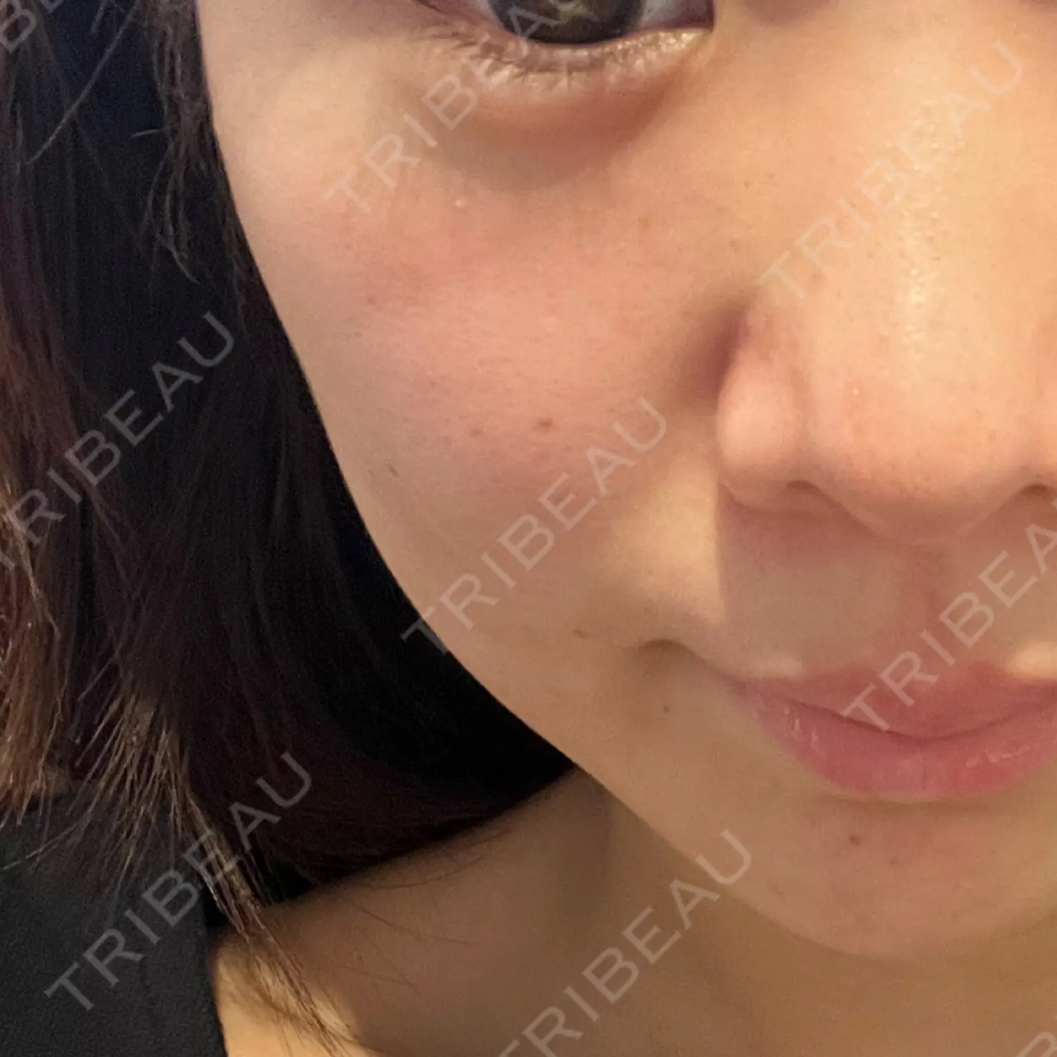 施術前の写真