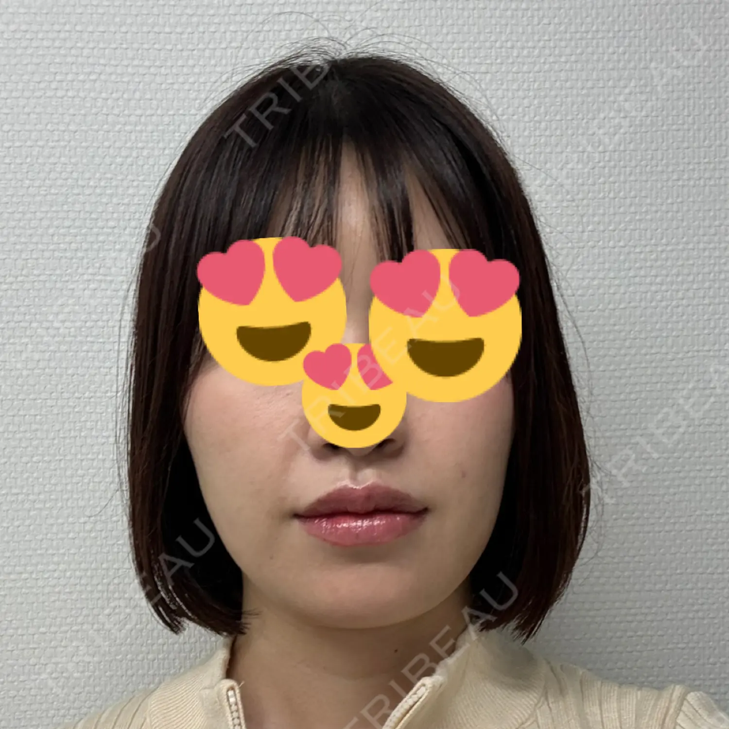 施術前の写真