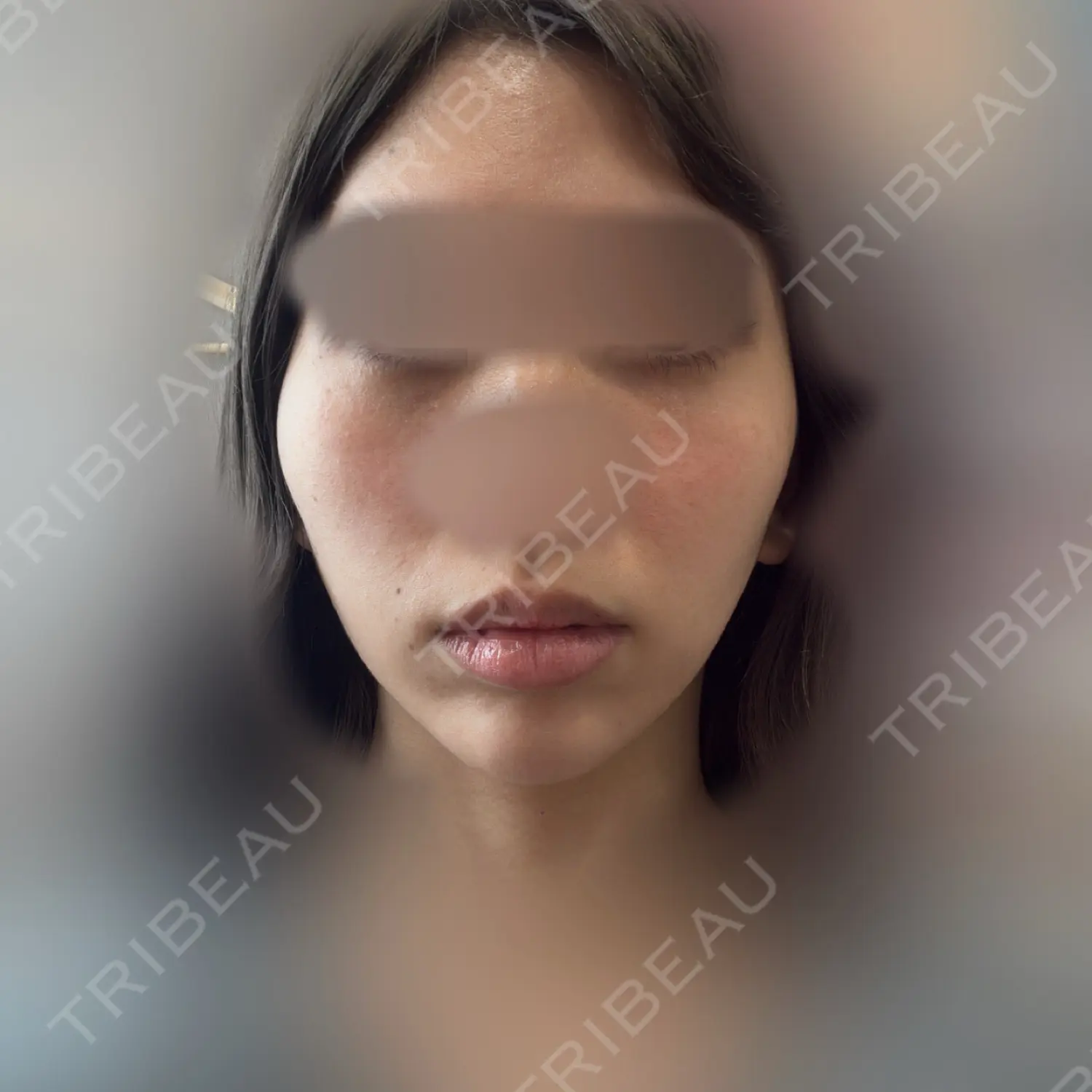 施術前の写真