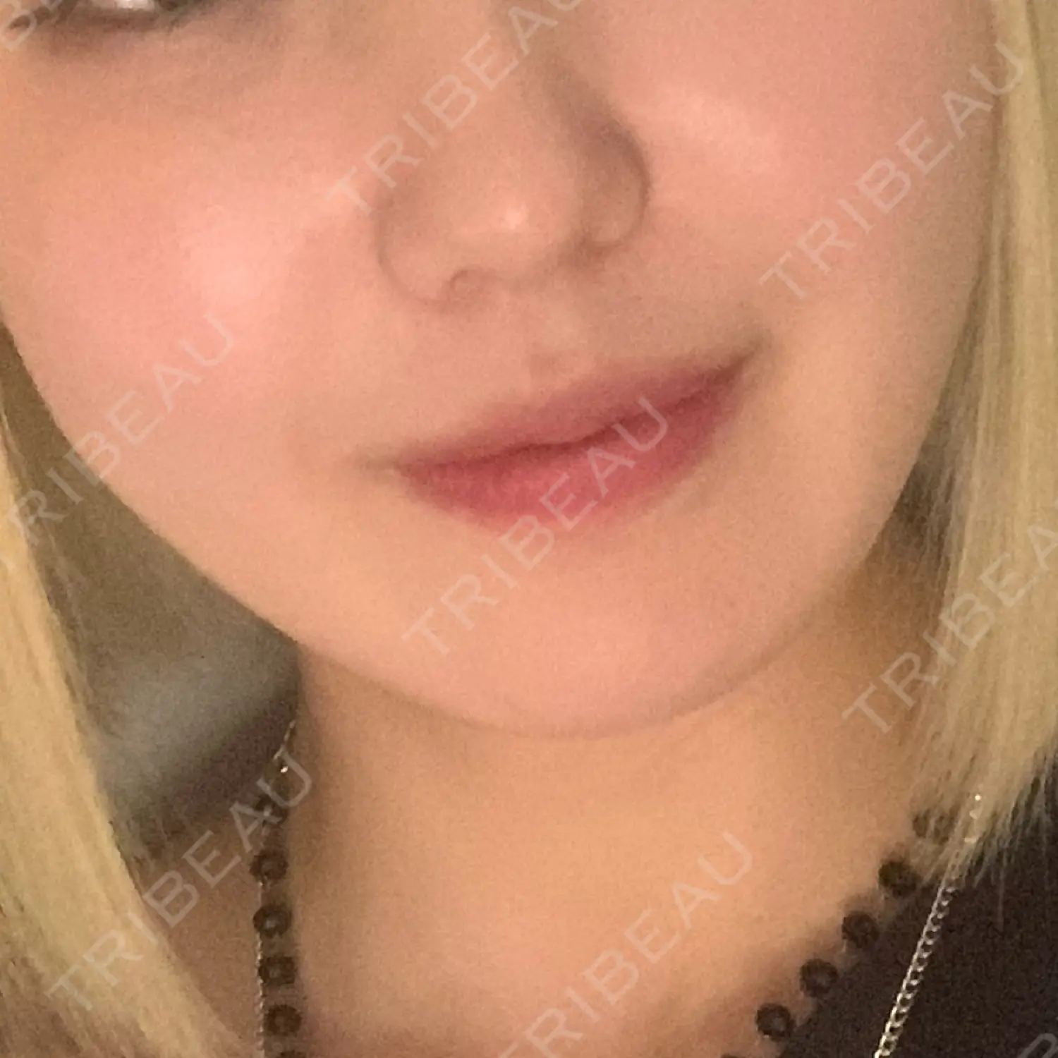 施術前の写真