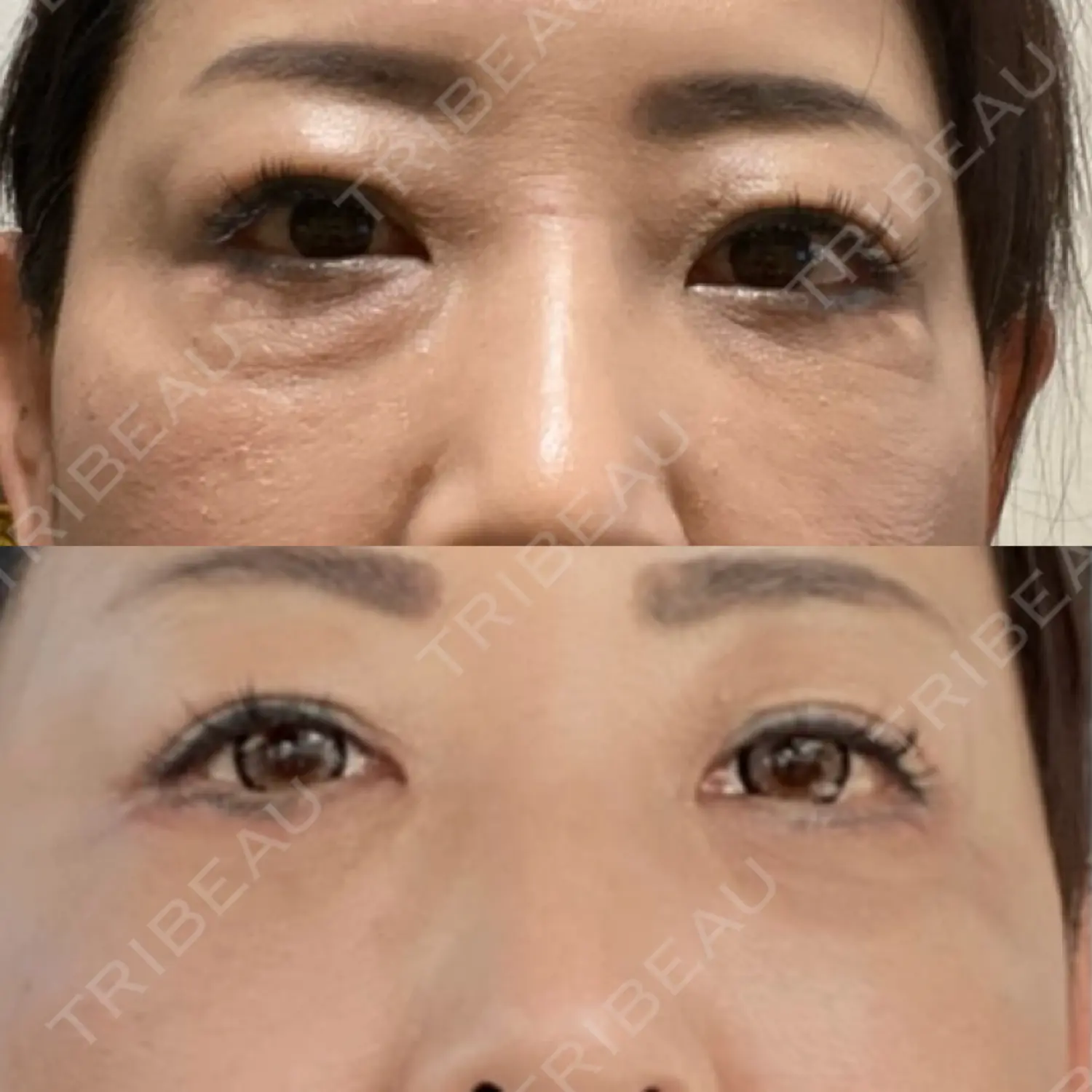 施術前の写真