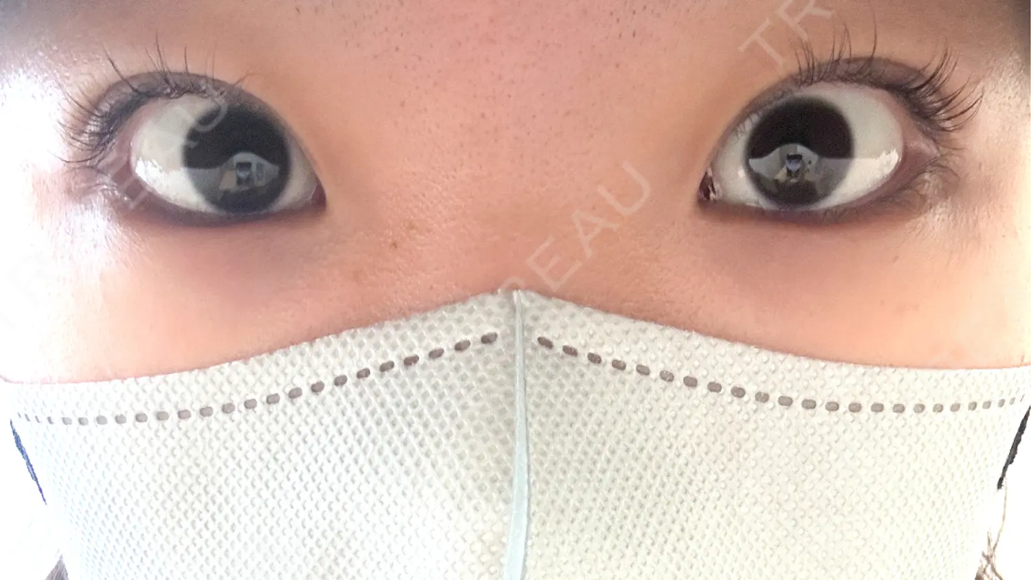 施術前の写真