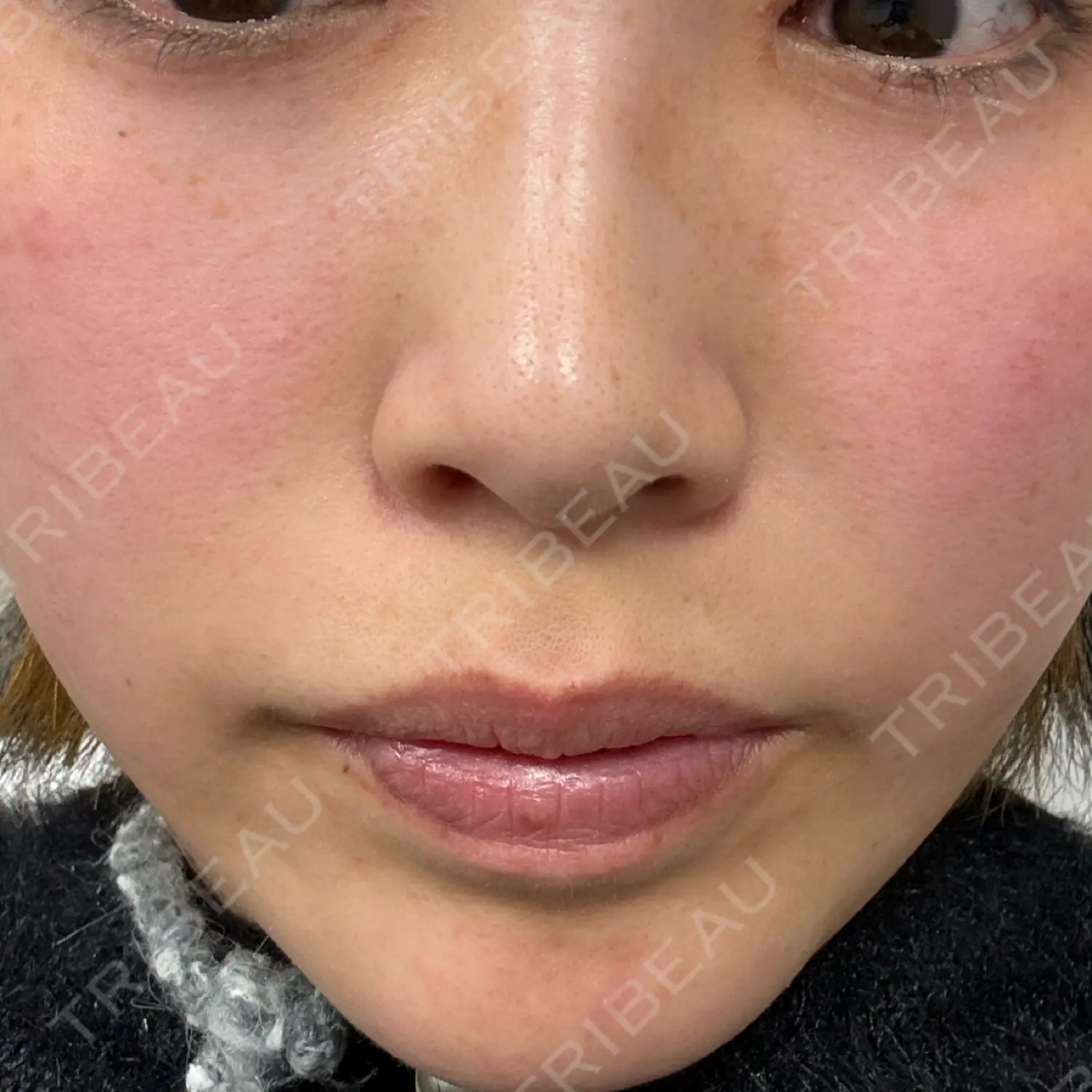 施術前の写真