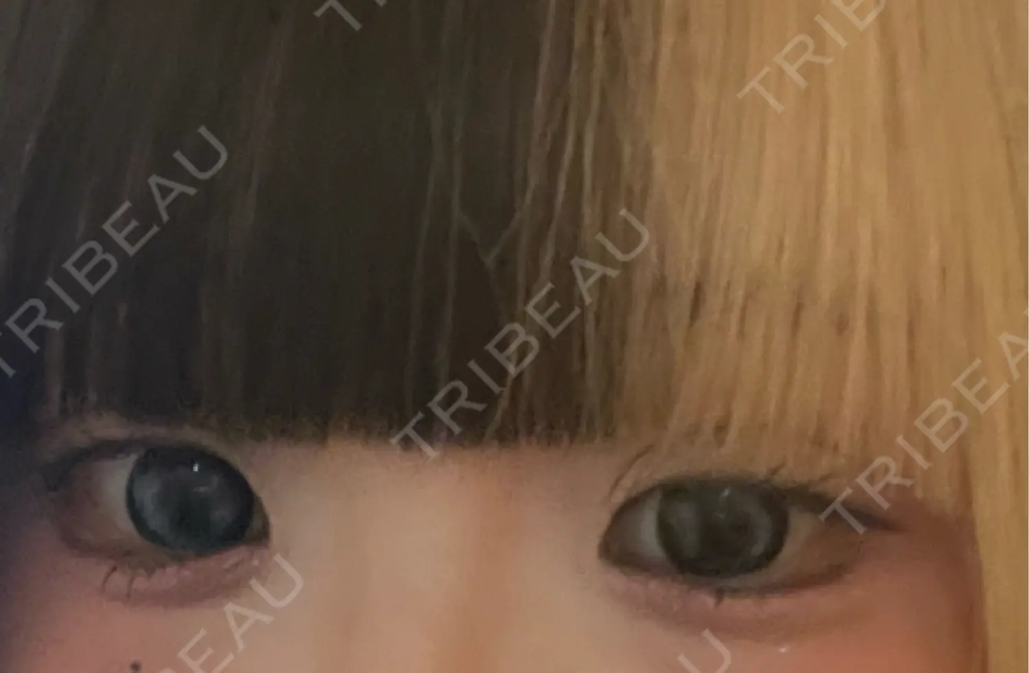 施術前の写真