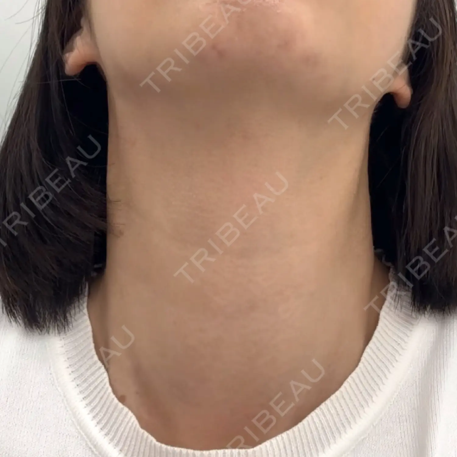 施術前の写真