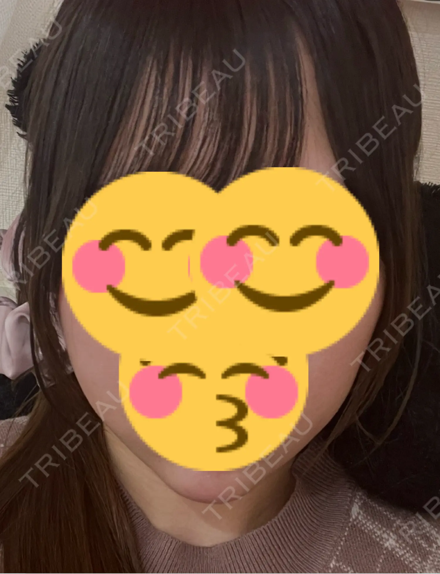 施術前の写真