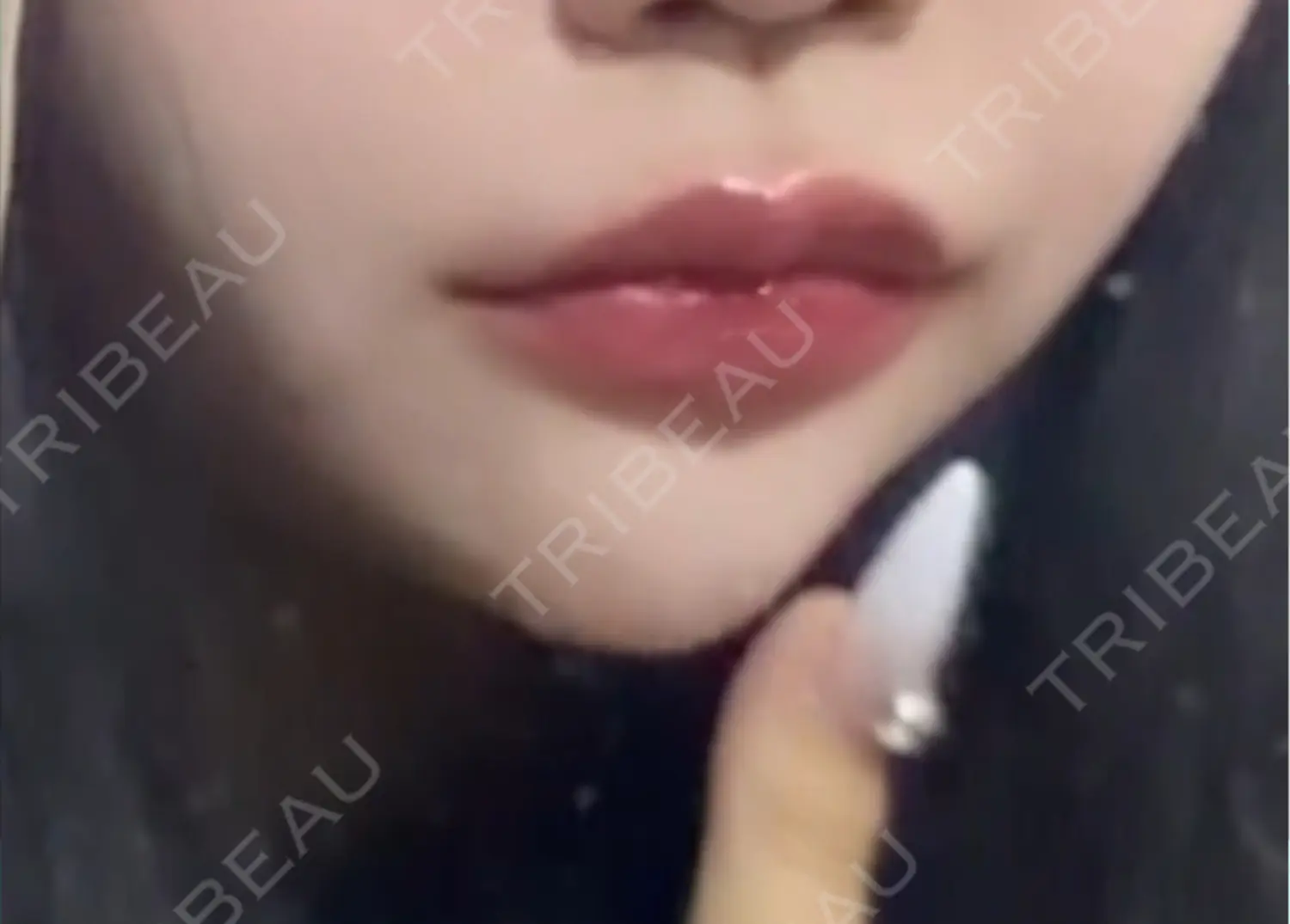 施術前の写真