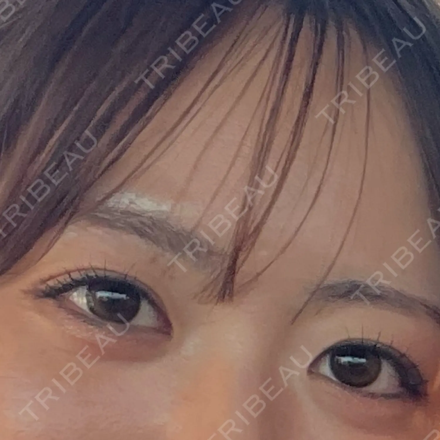 施術前の写真