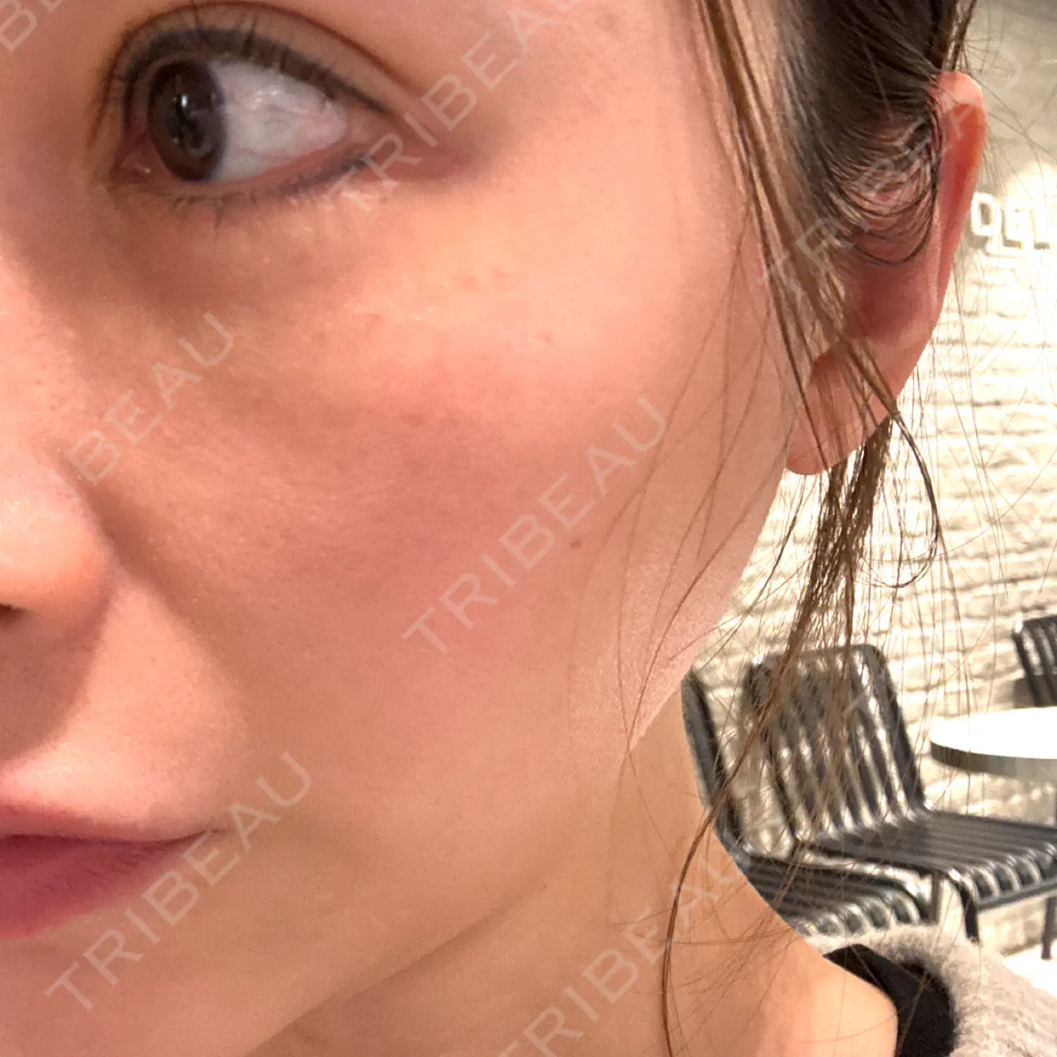 施術前の写真