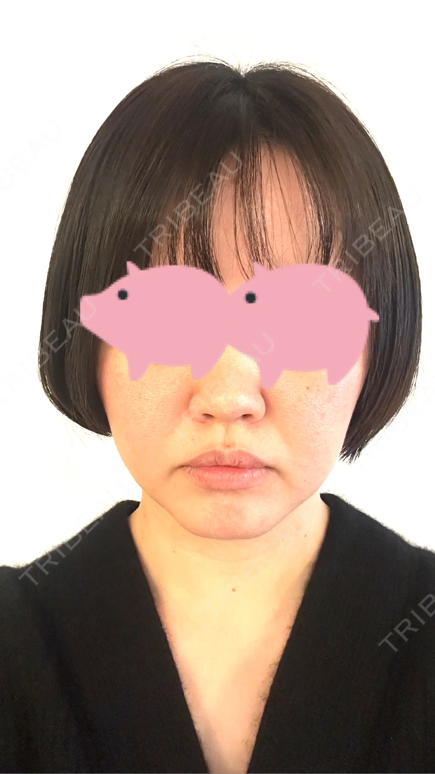 施術前の写真