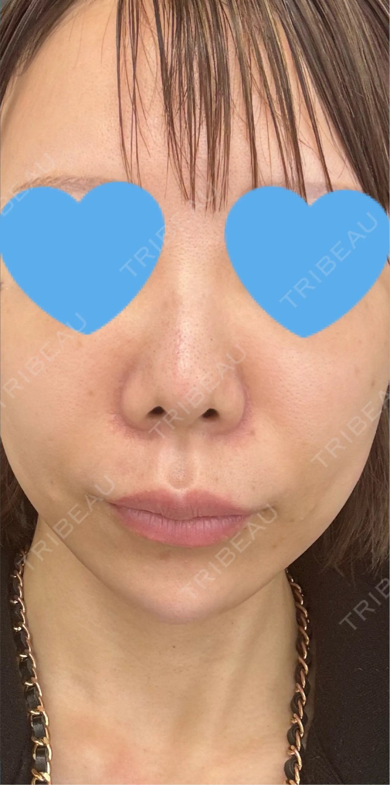 施術前の写真