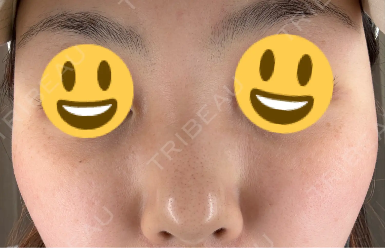 施術前の写真
