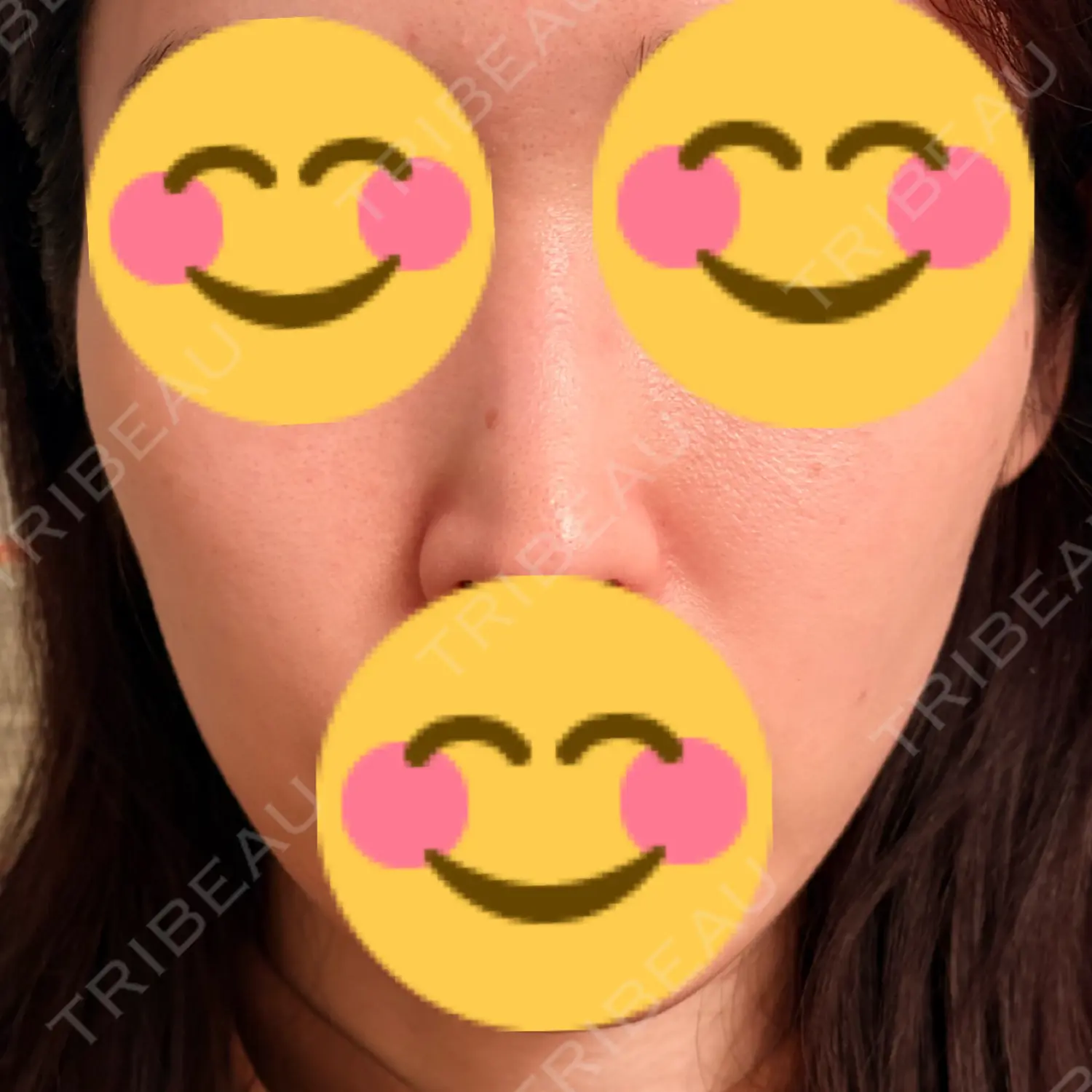 施術前の写真