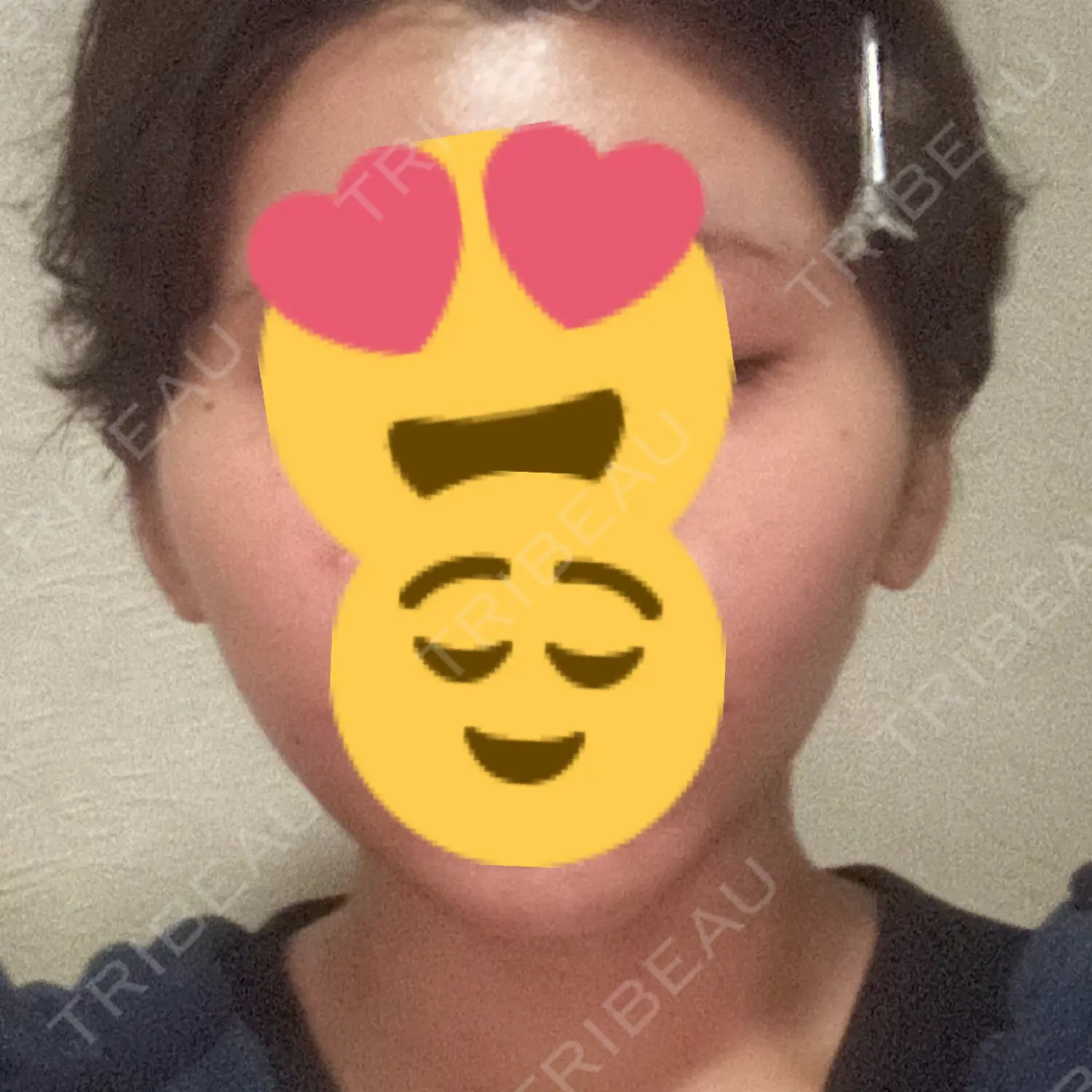 施術前の写真
