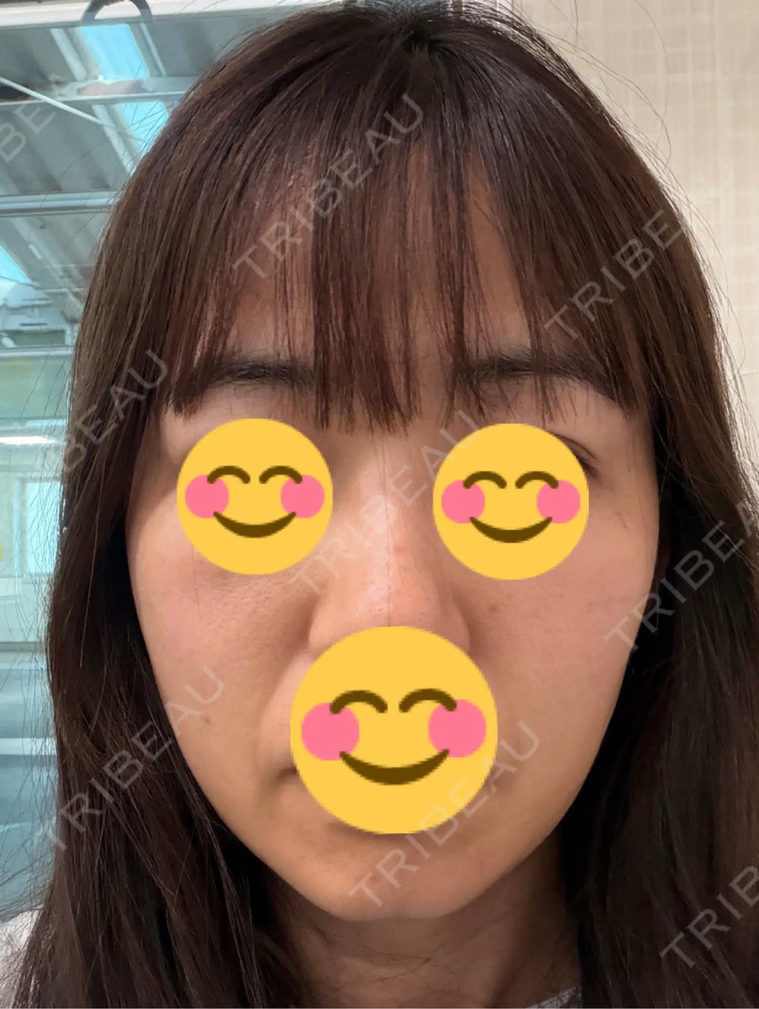 施術前の写真