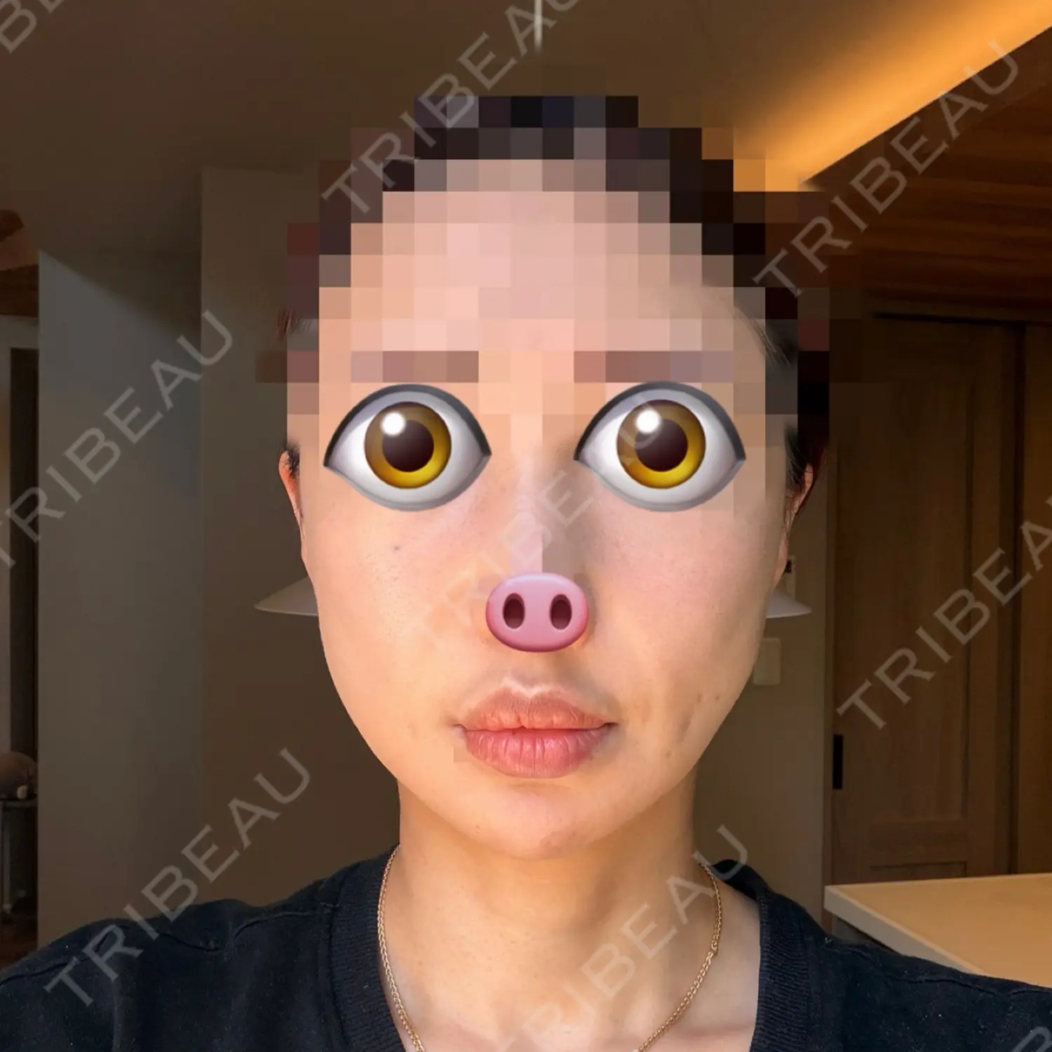 施術前の写真
