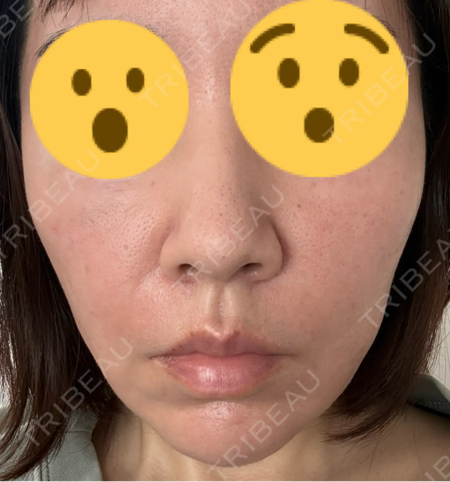 施術前の写真
