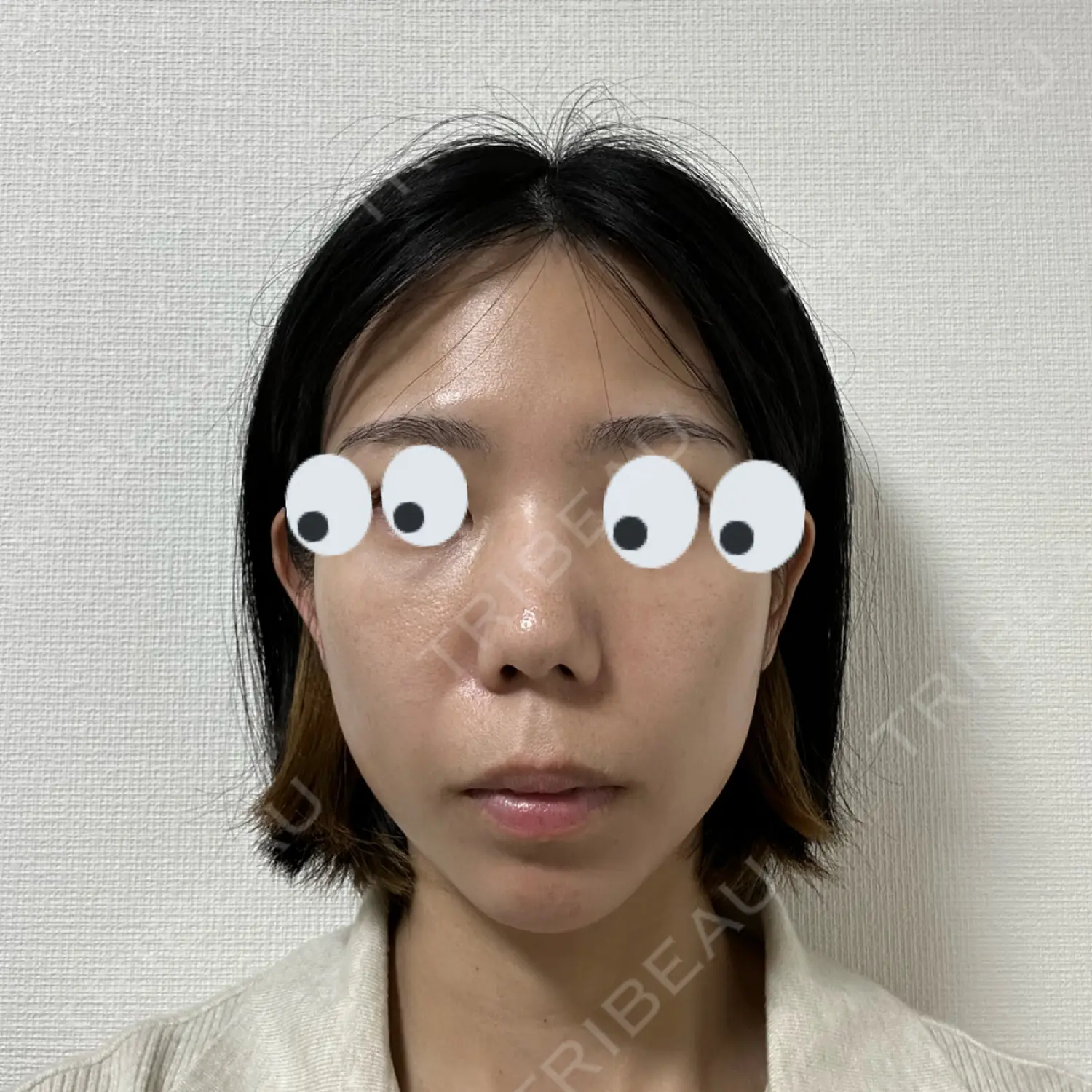 施術前の写真