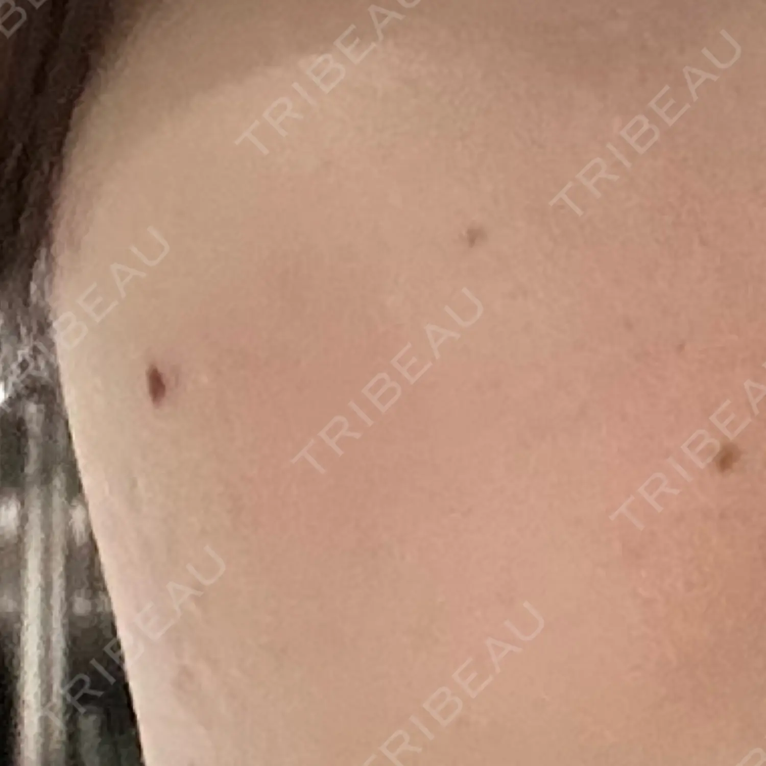 施術前の写真
