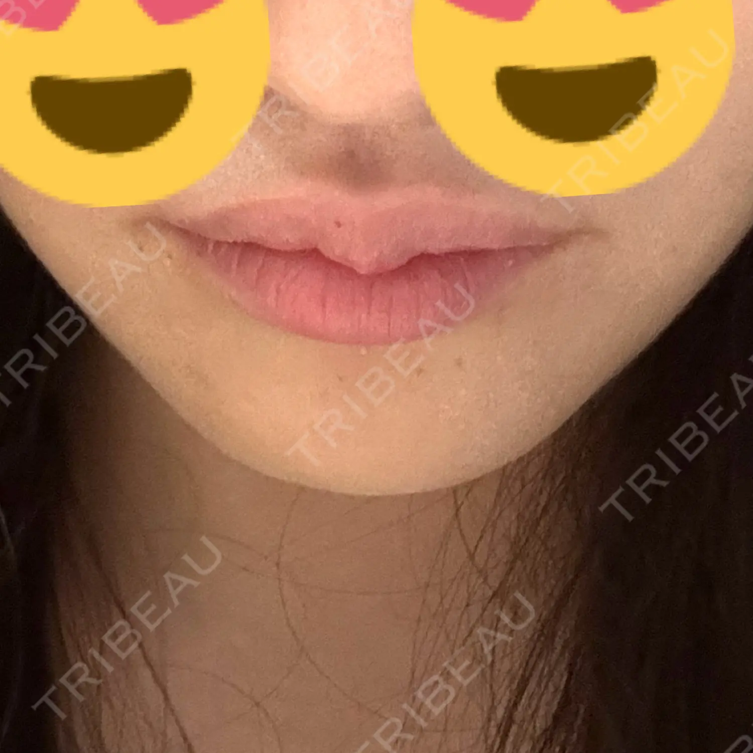 施術前の写真