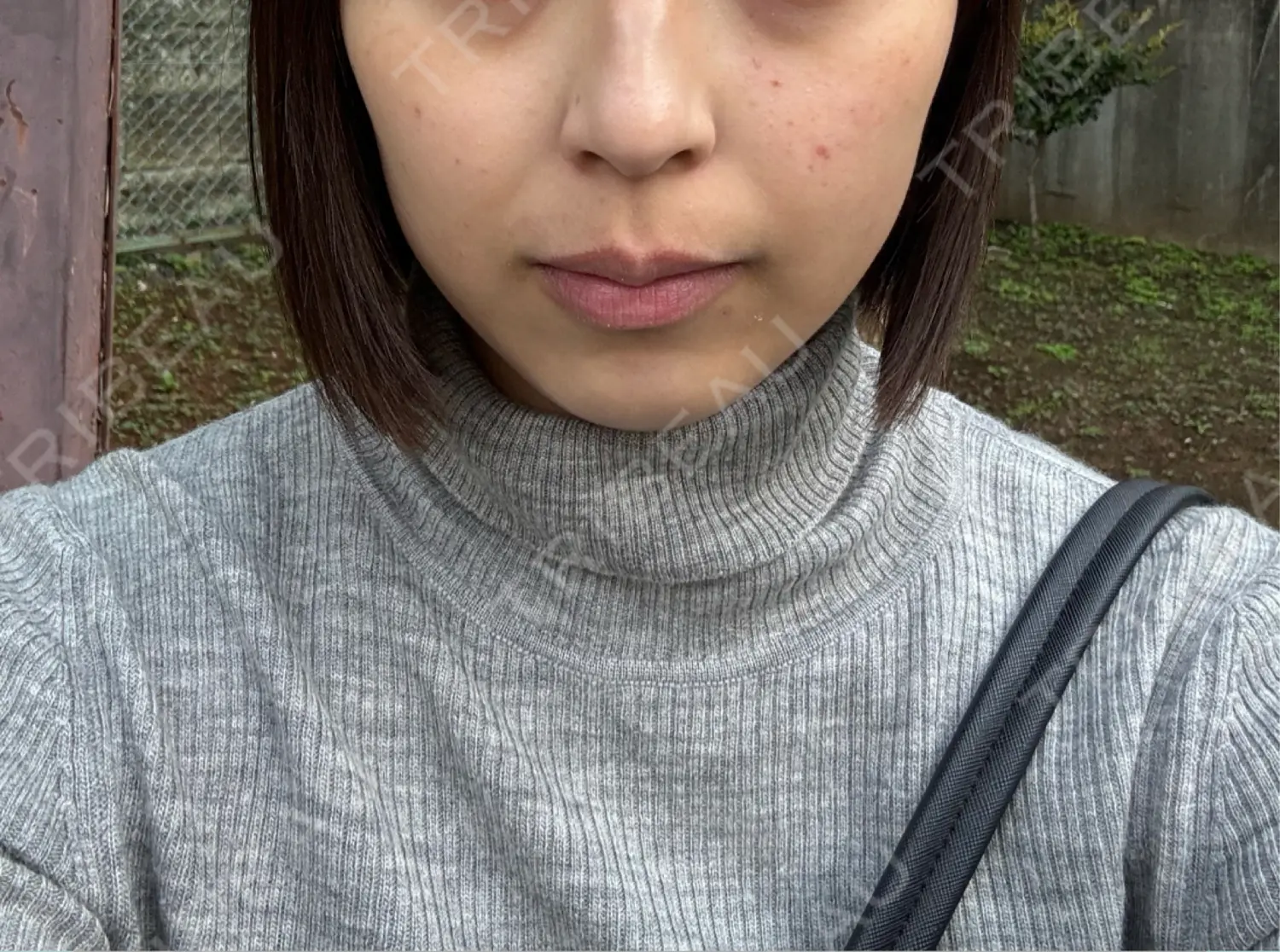 施術前の写真