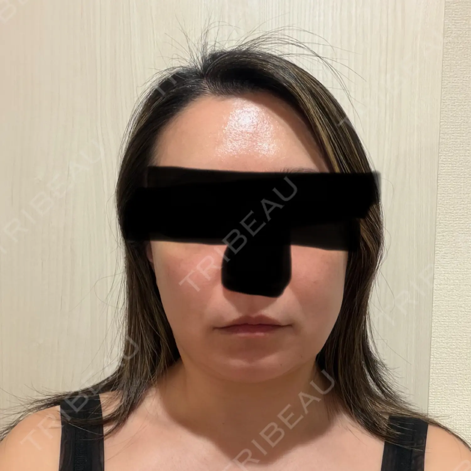 施術前の写真